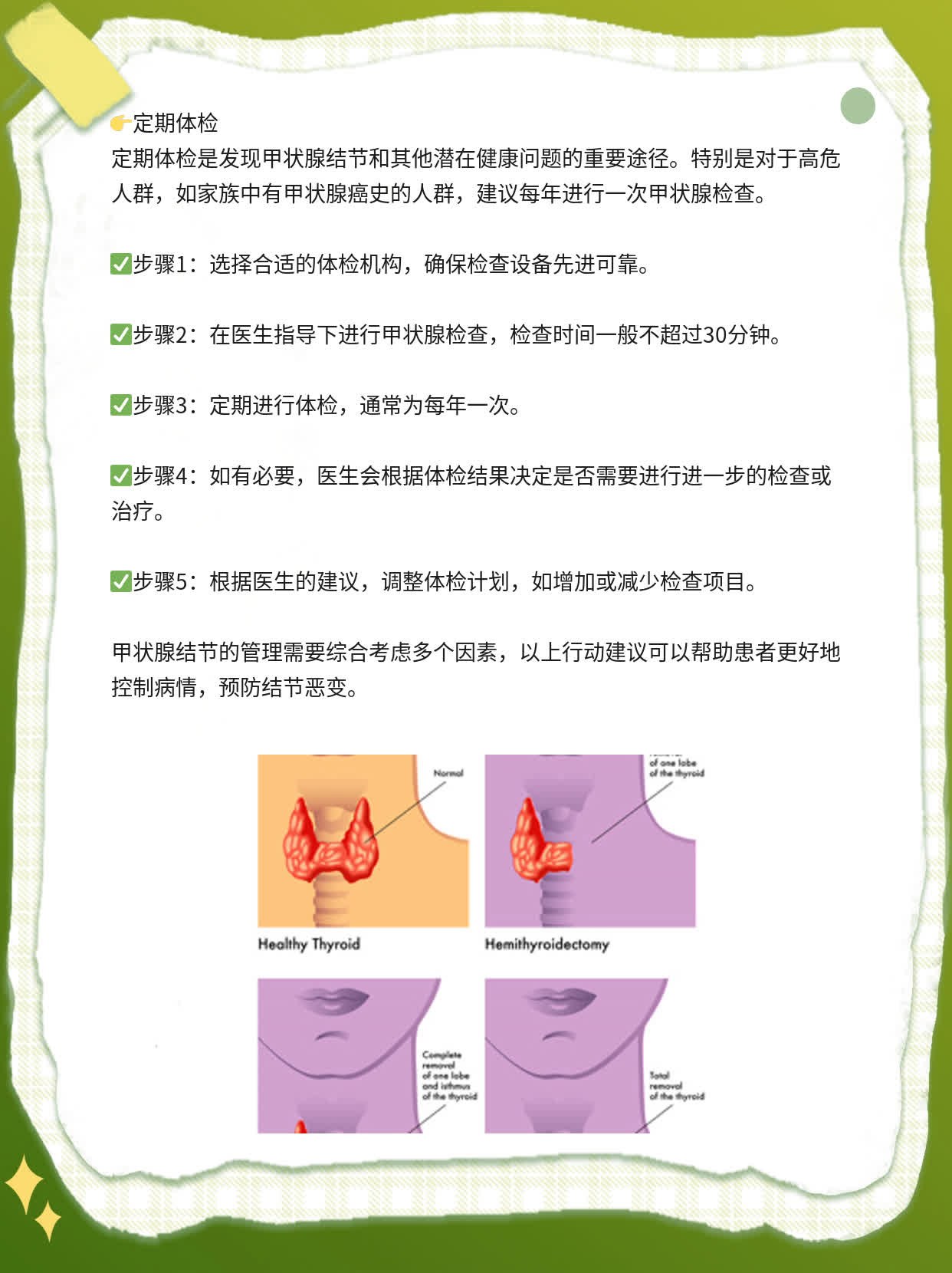 揭秘：甲状腺结节的症状及危害，你必须知道！