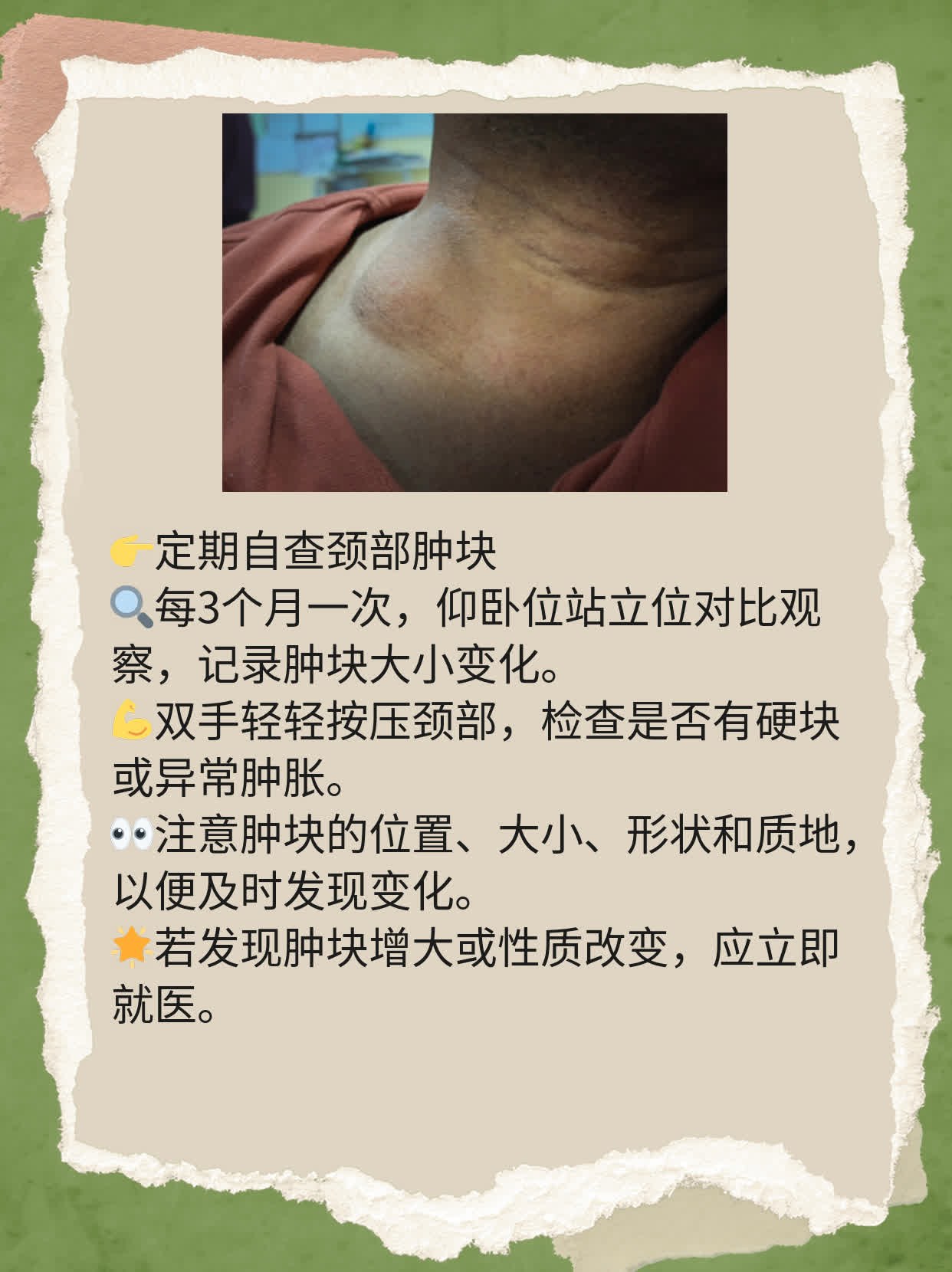 揭秘：甲状腺结节治疗妙招大公开！