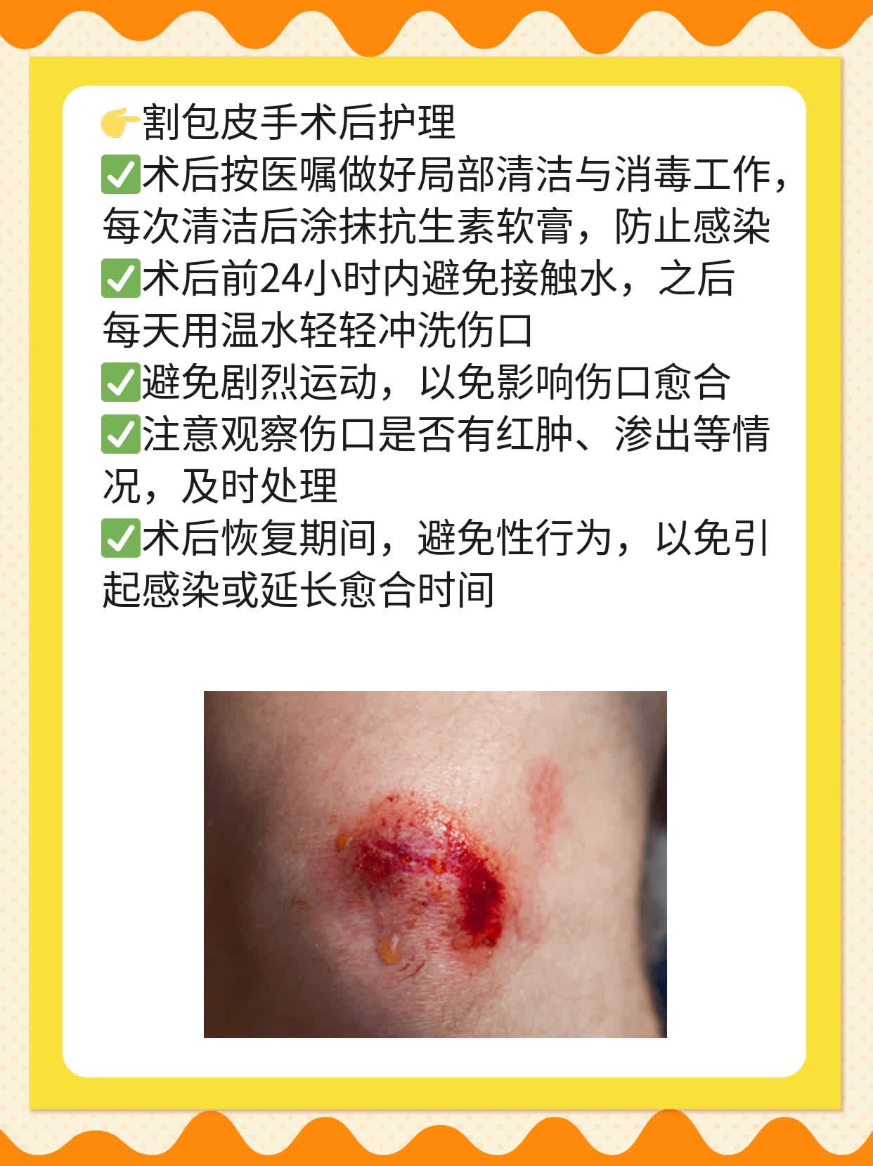 「男生私处有白白的东西」快速解决法！