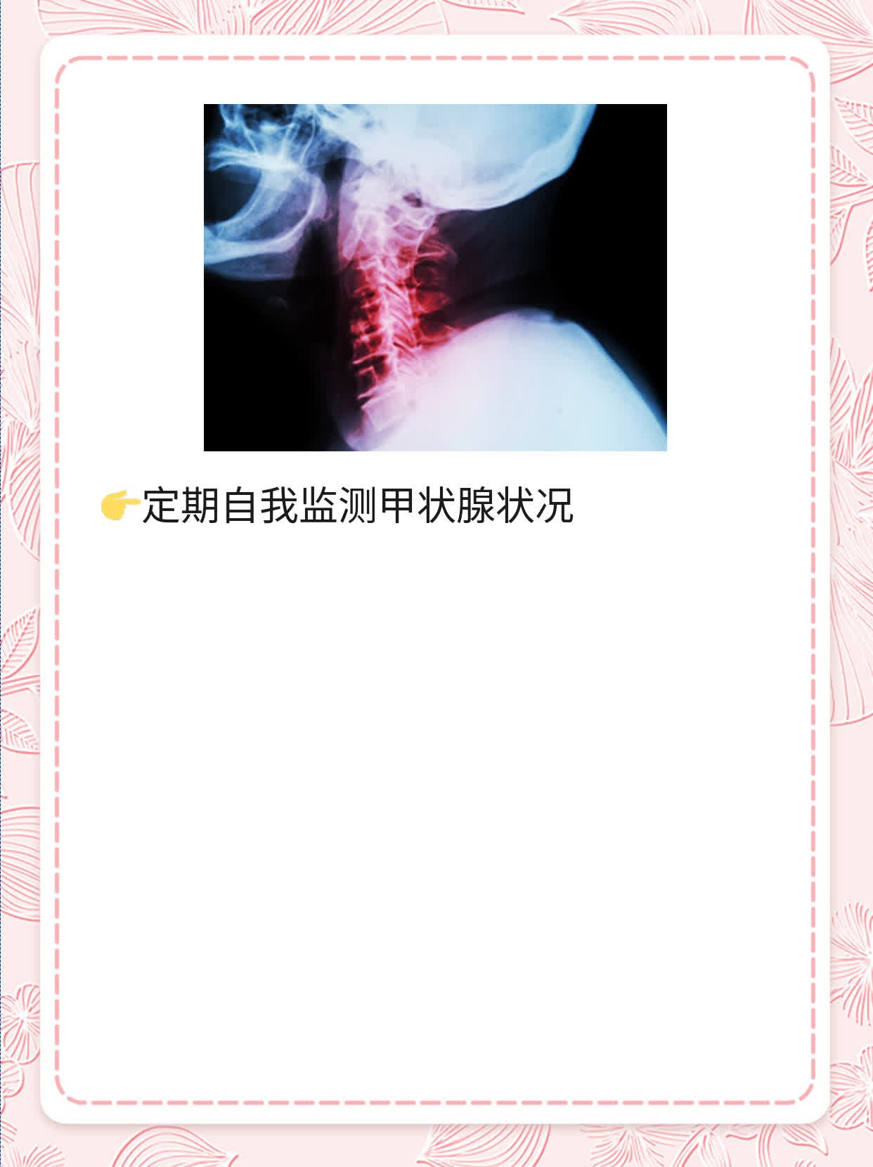 探秘TG抗体升高的原因：揭秘甲状腺球蛋白异常！
