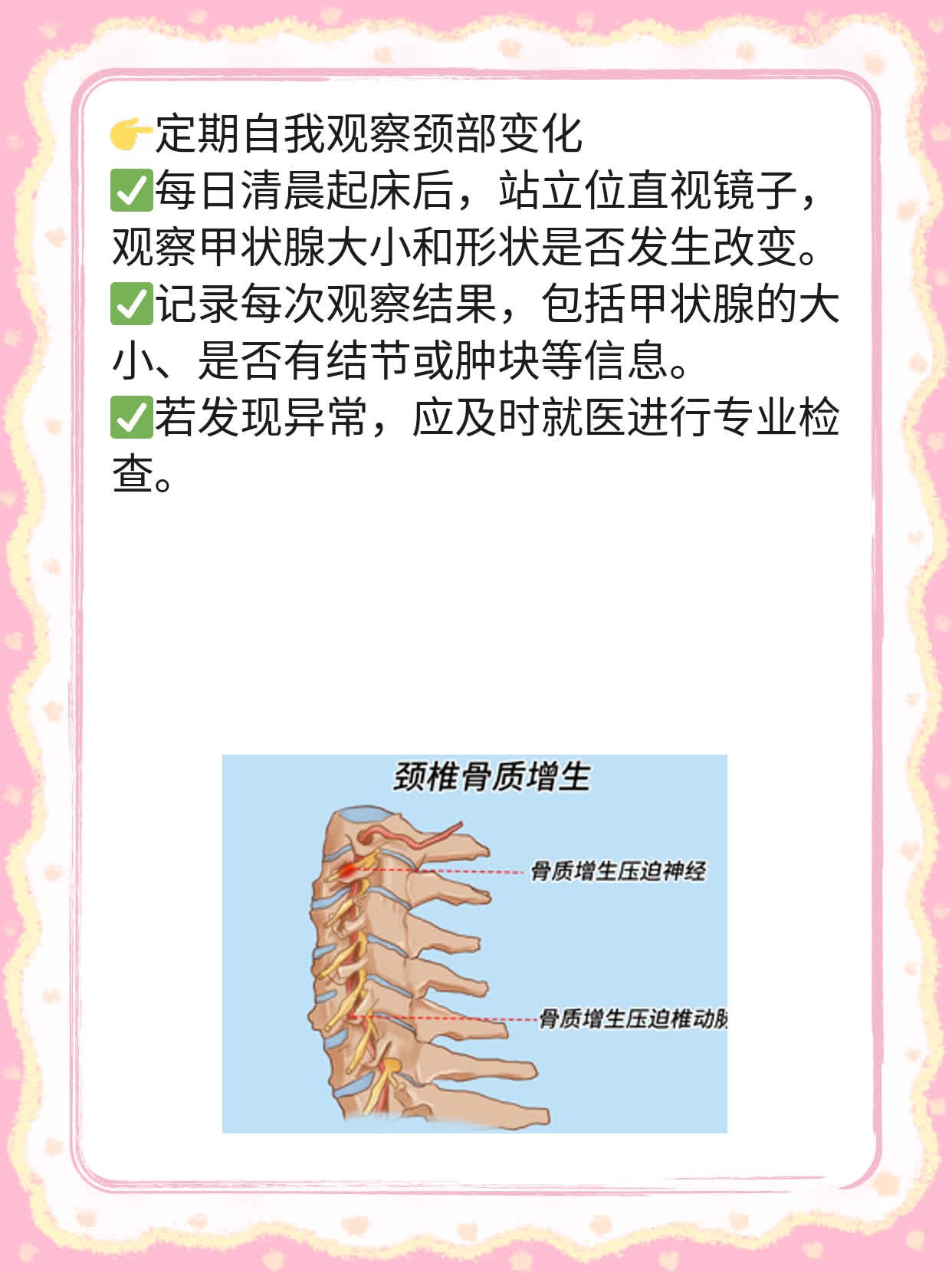 「图解」甲状腺肿大一、二、三度区别