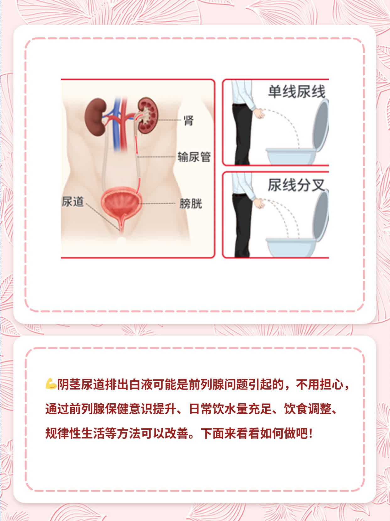 揭秘：阴茎尿道排出白液的原因及解决方法