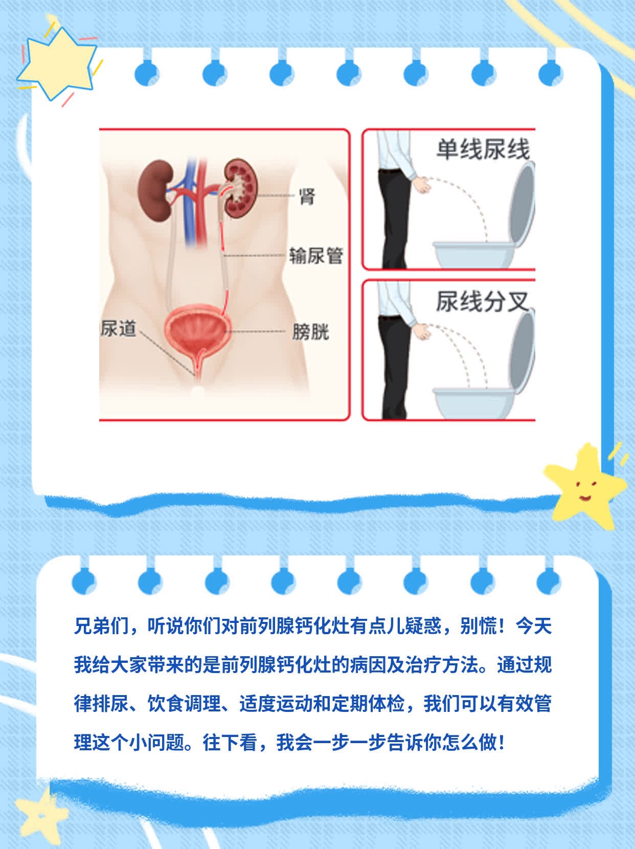 「答疑」前列腺钙化灶的病因及治疗方法