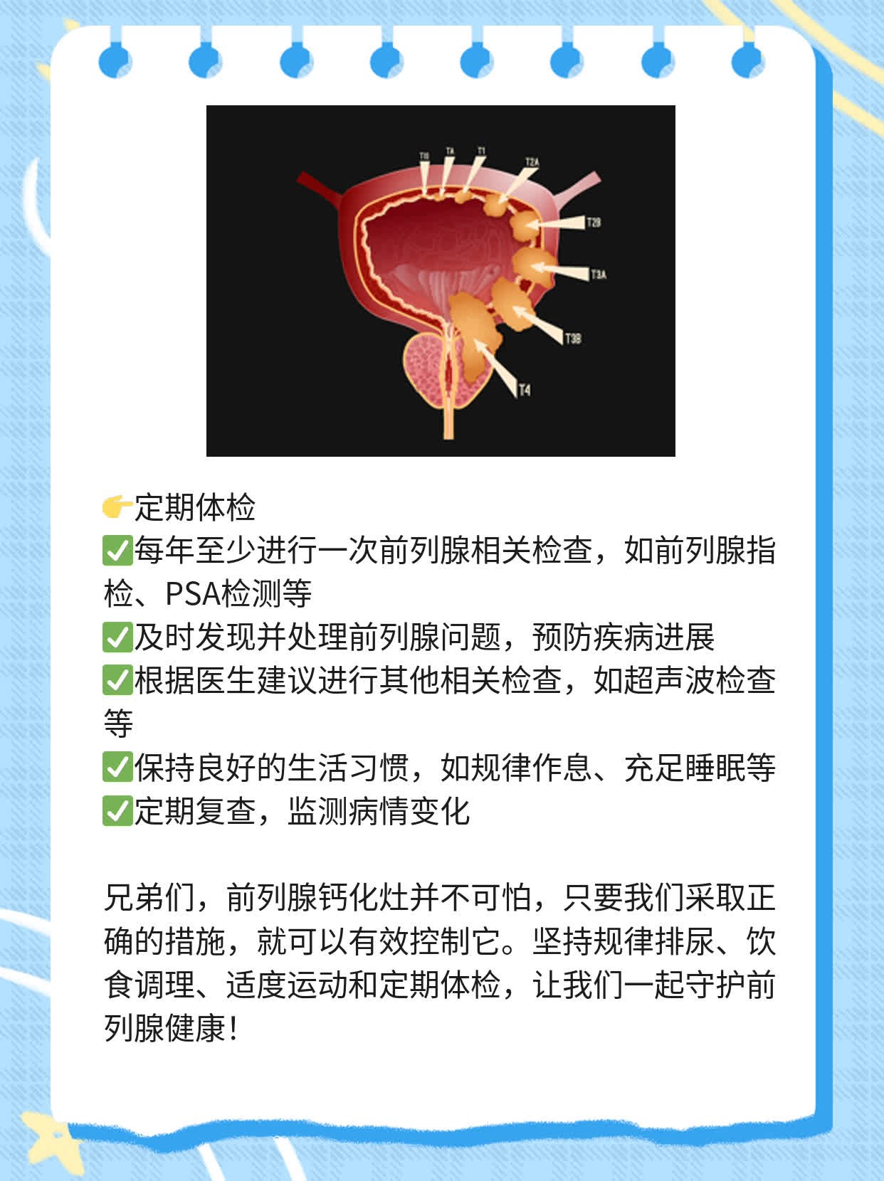 「答疑」前列腺钙化灶的病因及治疗方法