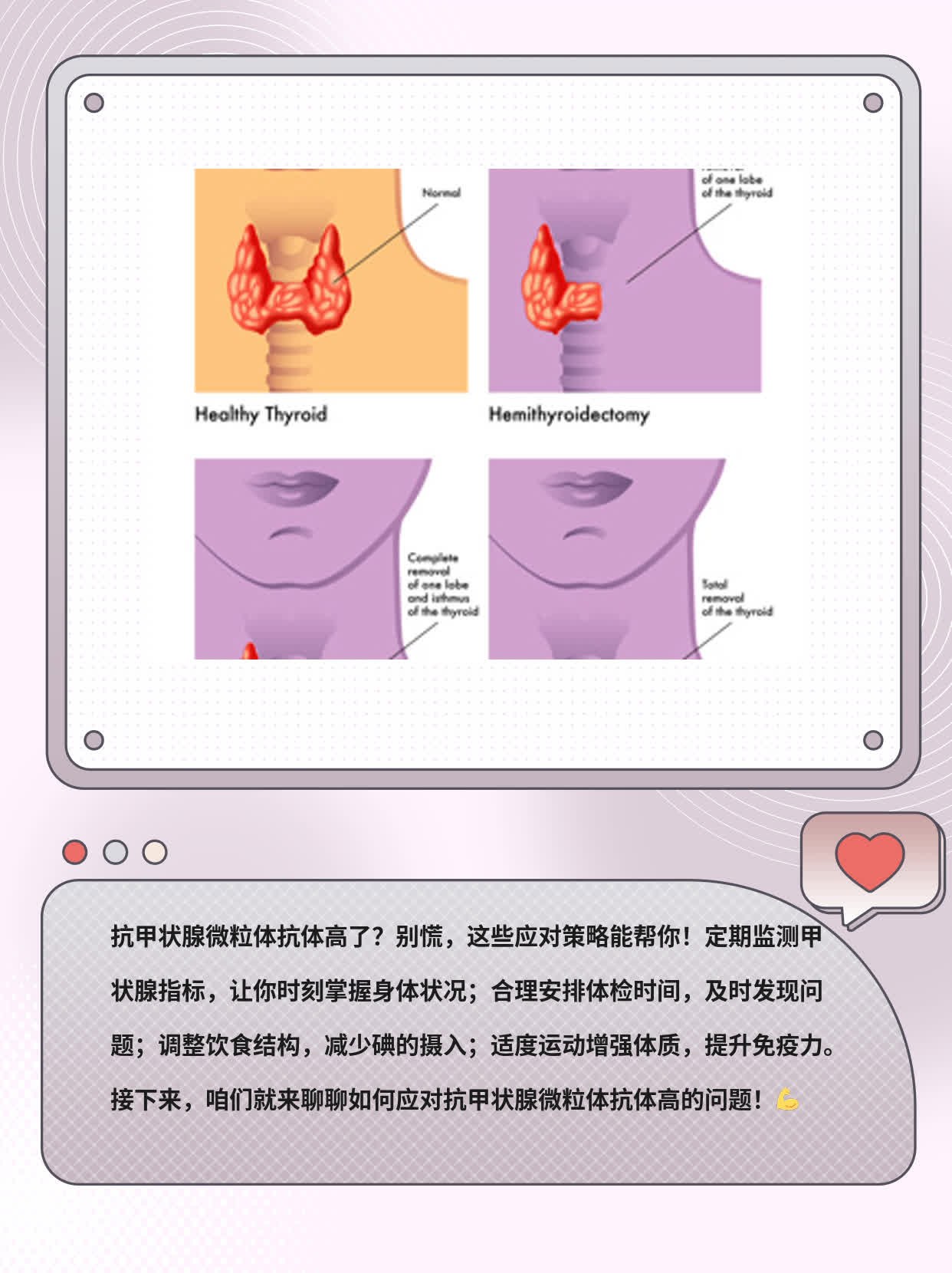 抗甲抗体高了？来聊聊抗甲抗体高的应对策略！