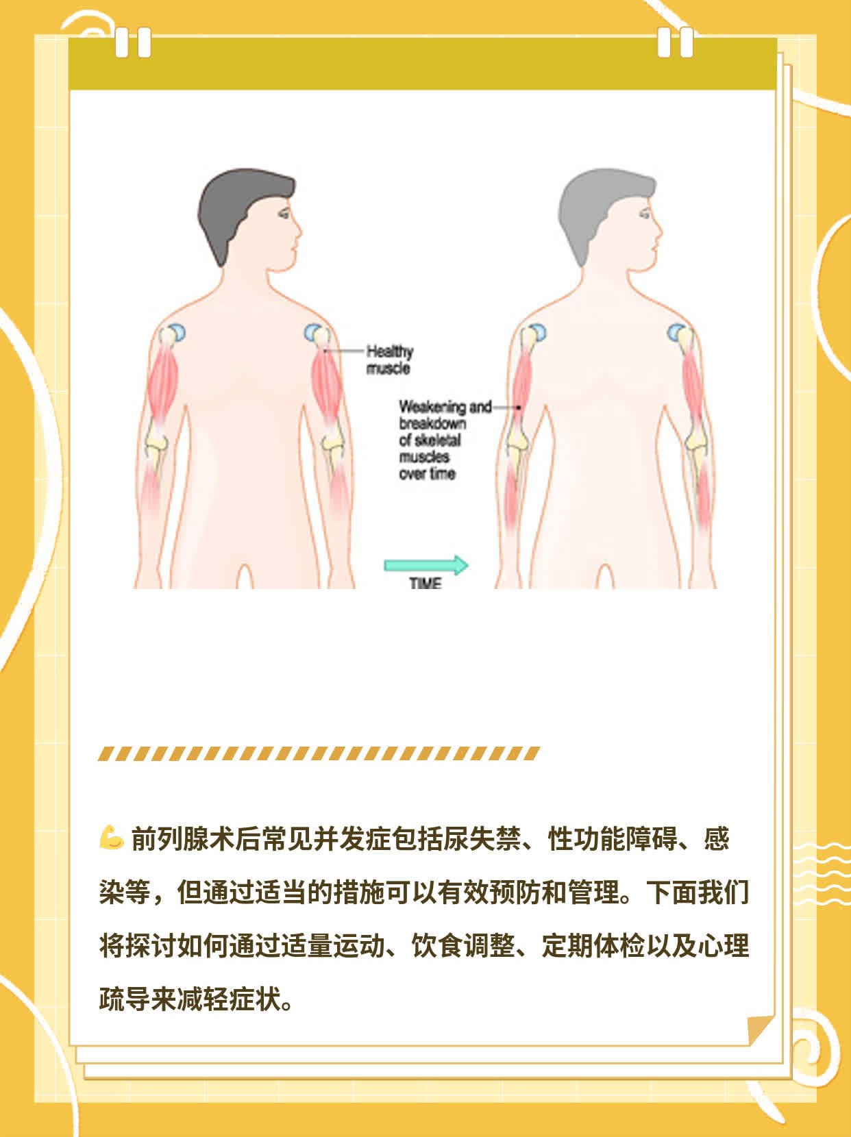 前列腺术后常见并发症探秘