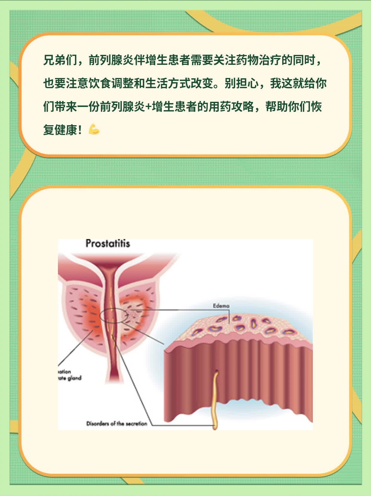 前列腺炎+增生患者的用药攻略