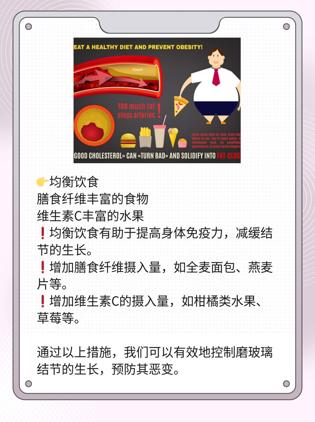 磨玻璃结节变大了？别慌！经验分享来帮你！