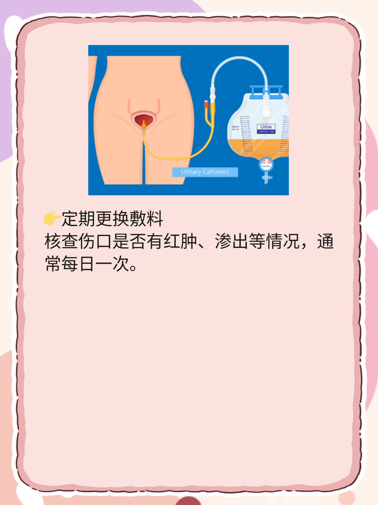 揭秘包茎术后阴茎真面目：图集大公开！