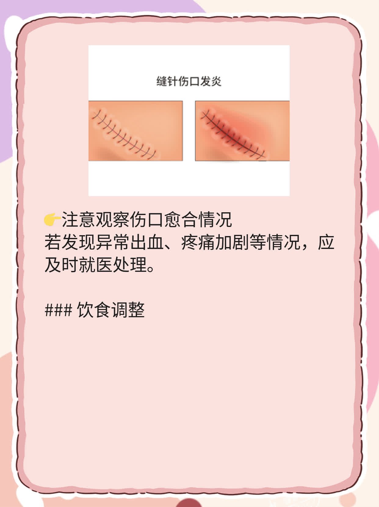 揭秘包茎术后阴茎真面目：图集大公开！