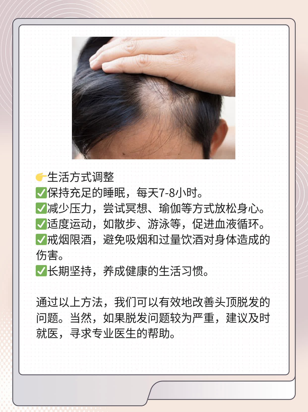 揭秘：男人头顶光秃秃的原因