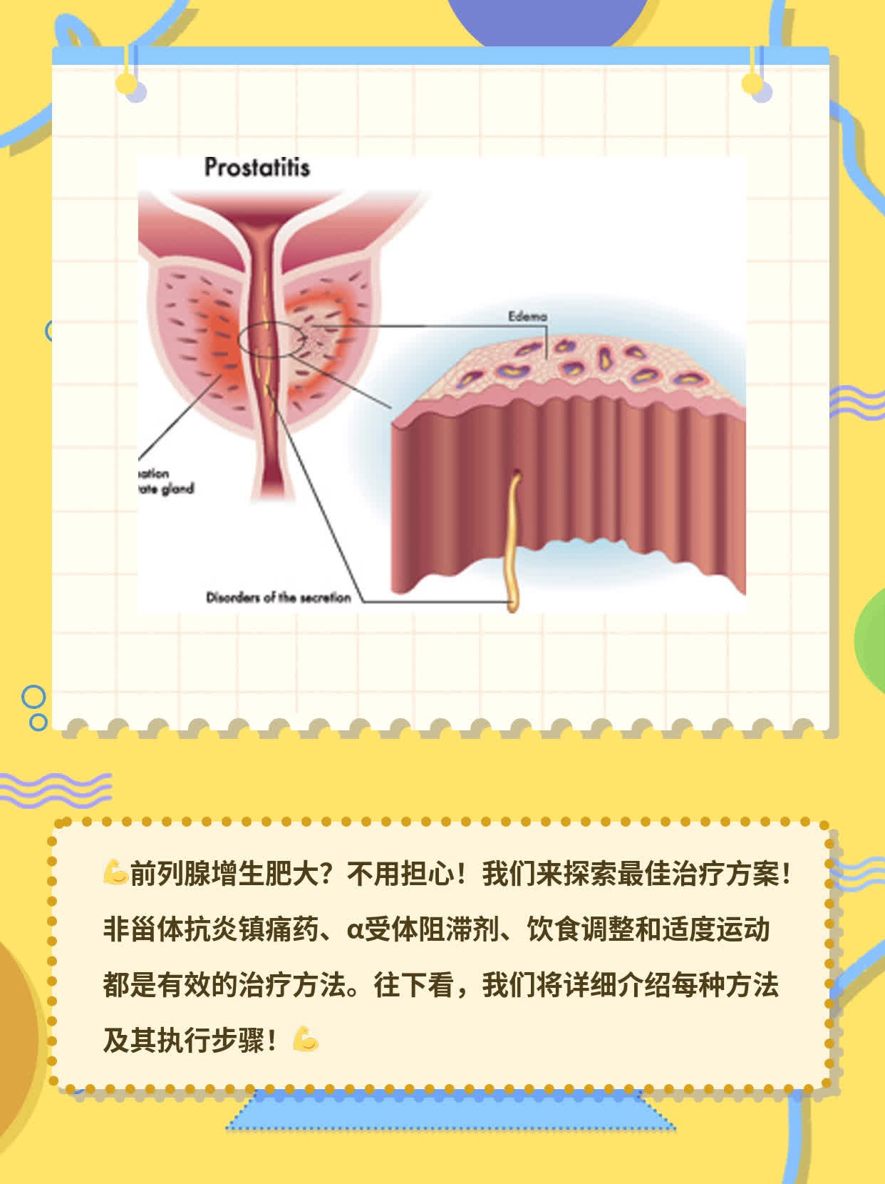 前列腺增生肥大：最佳治疗方案探秘