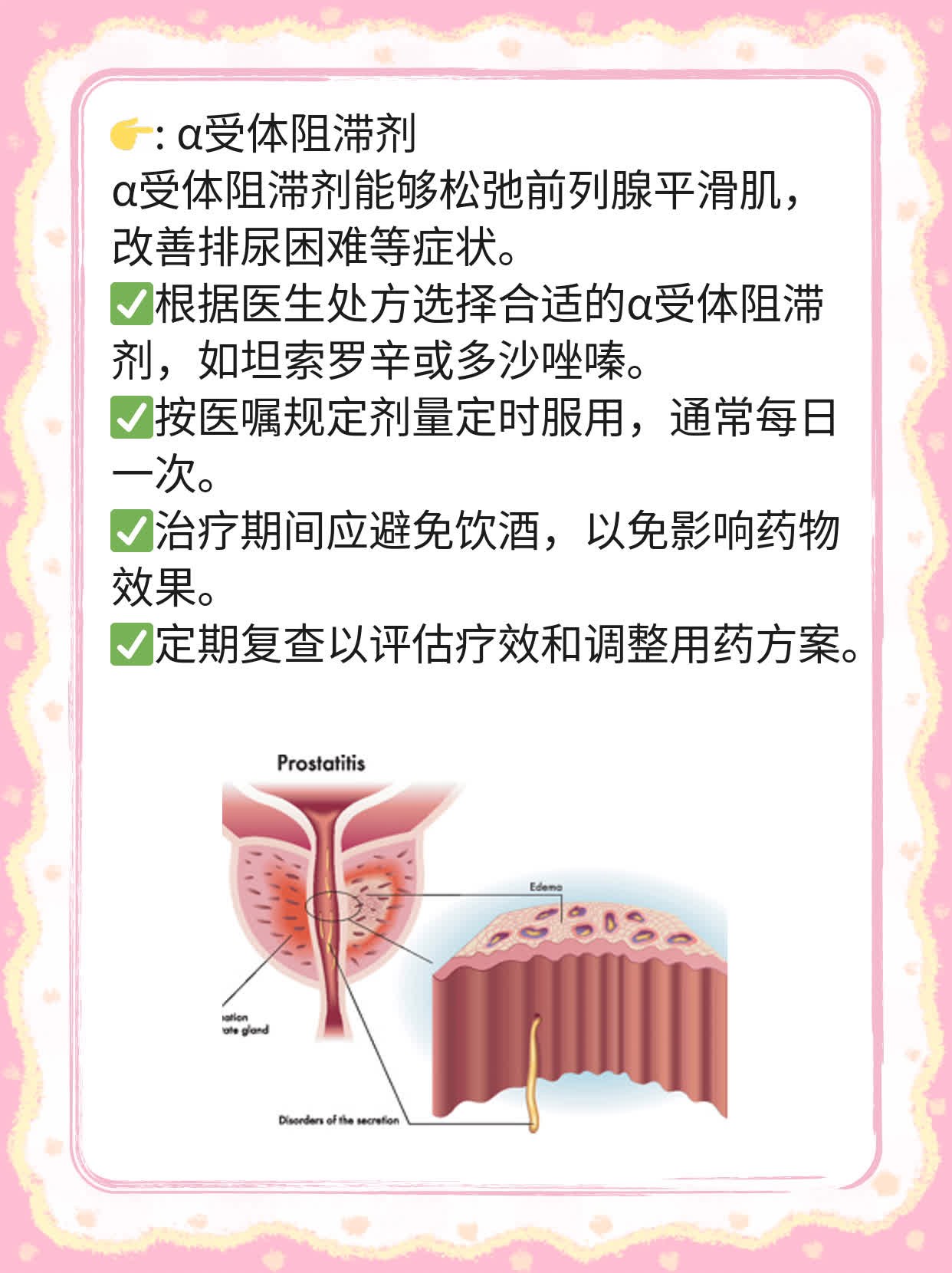 「揭秘」前列腺肿大的原因及处理方法