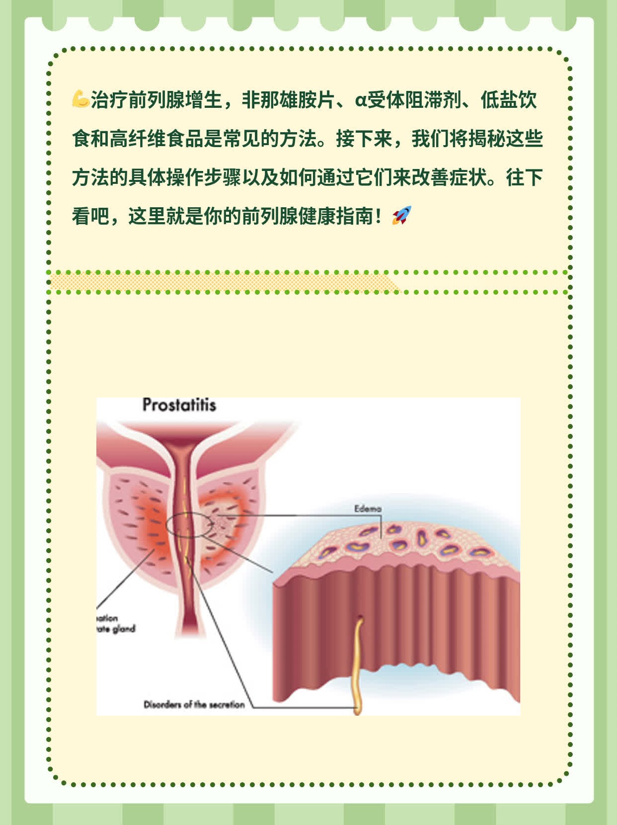 「经验分享」治疗前列腺增生的最佳方案探秘