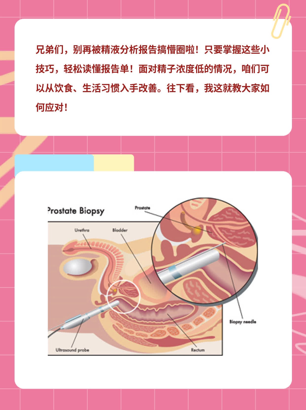 解密精液分析报告：新手也能看懂！