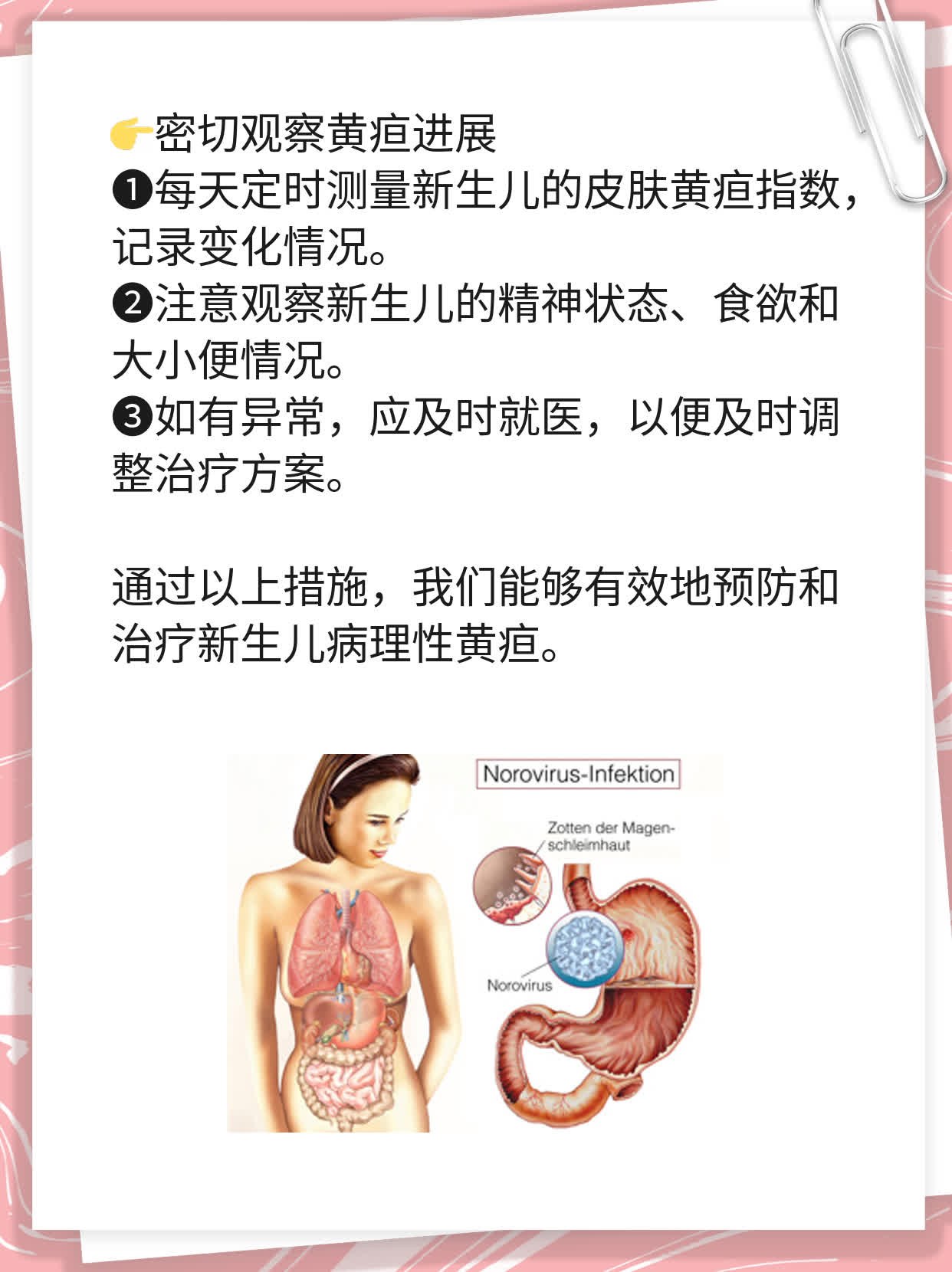 「新生儿病理性黄疸」：探究原因及处理方法！