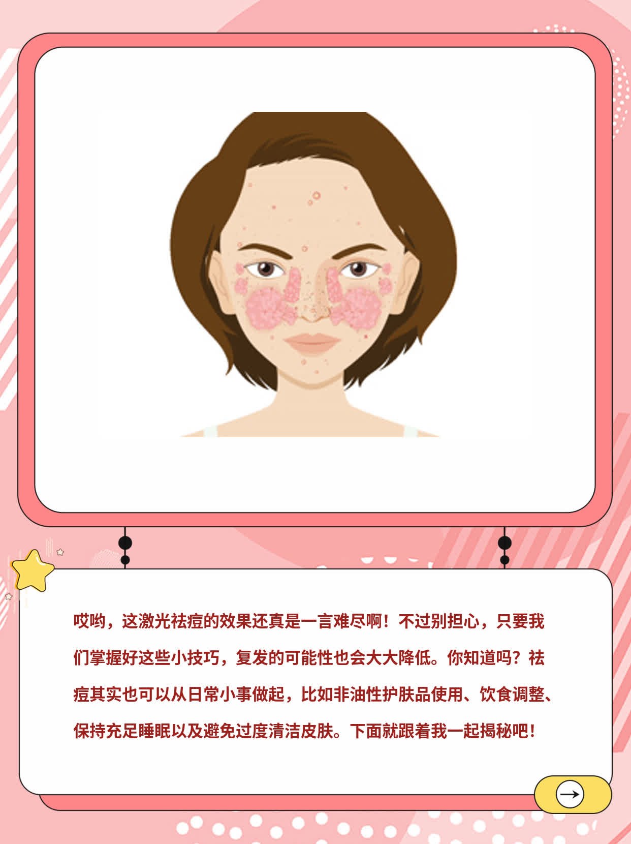 揭秘：激光祛痘效果及复发可能性大公开！