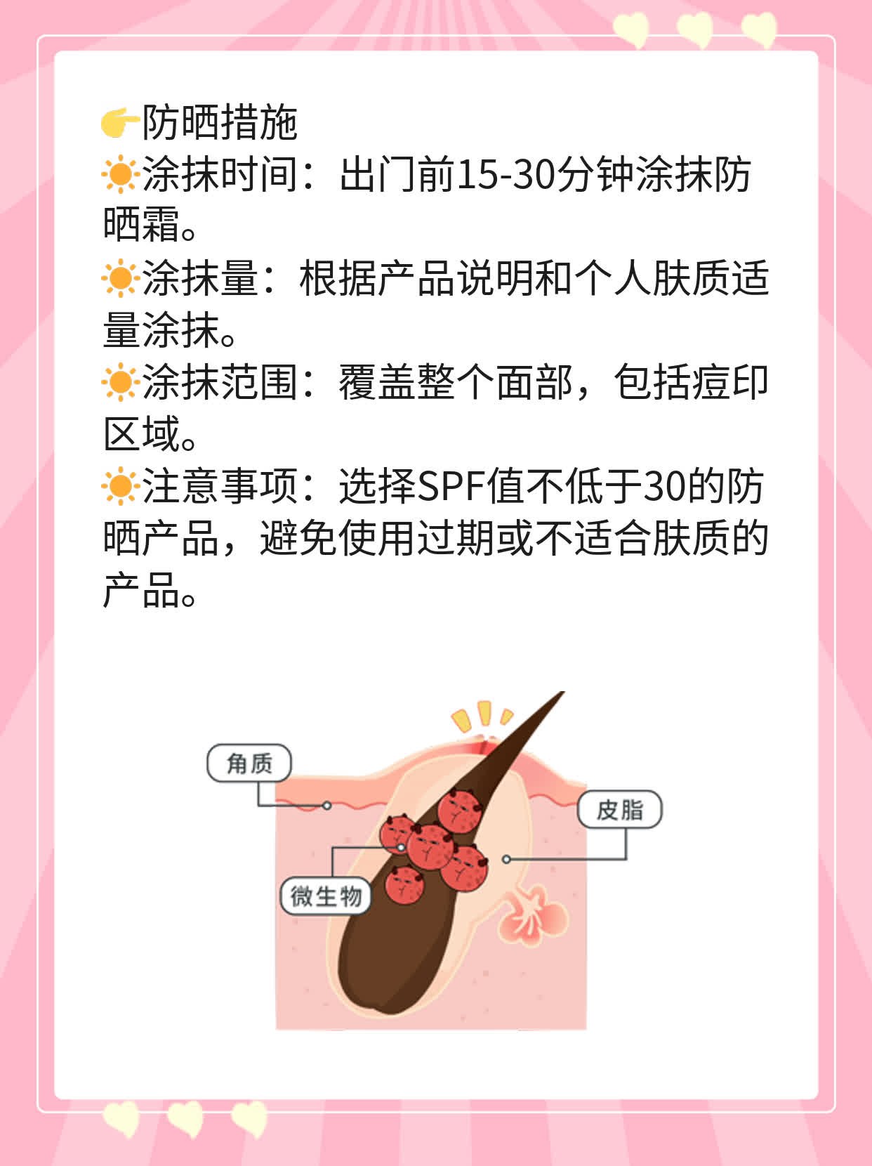 「祛痘印」激光价格揭秘：X万元能搞定几回？