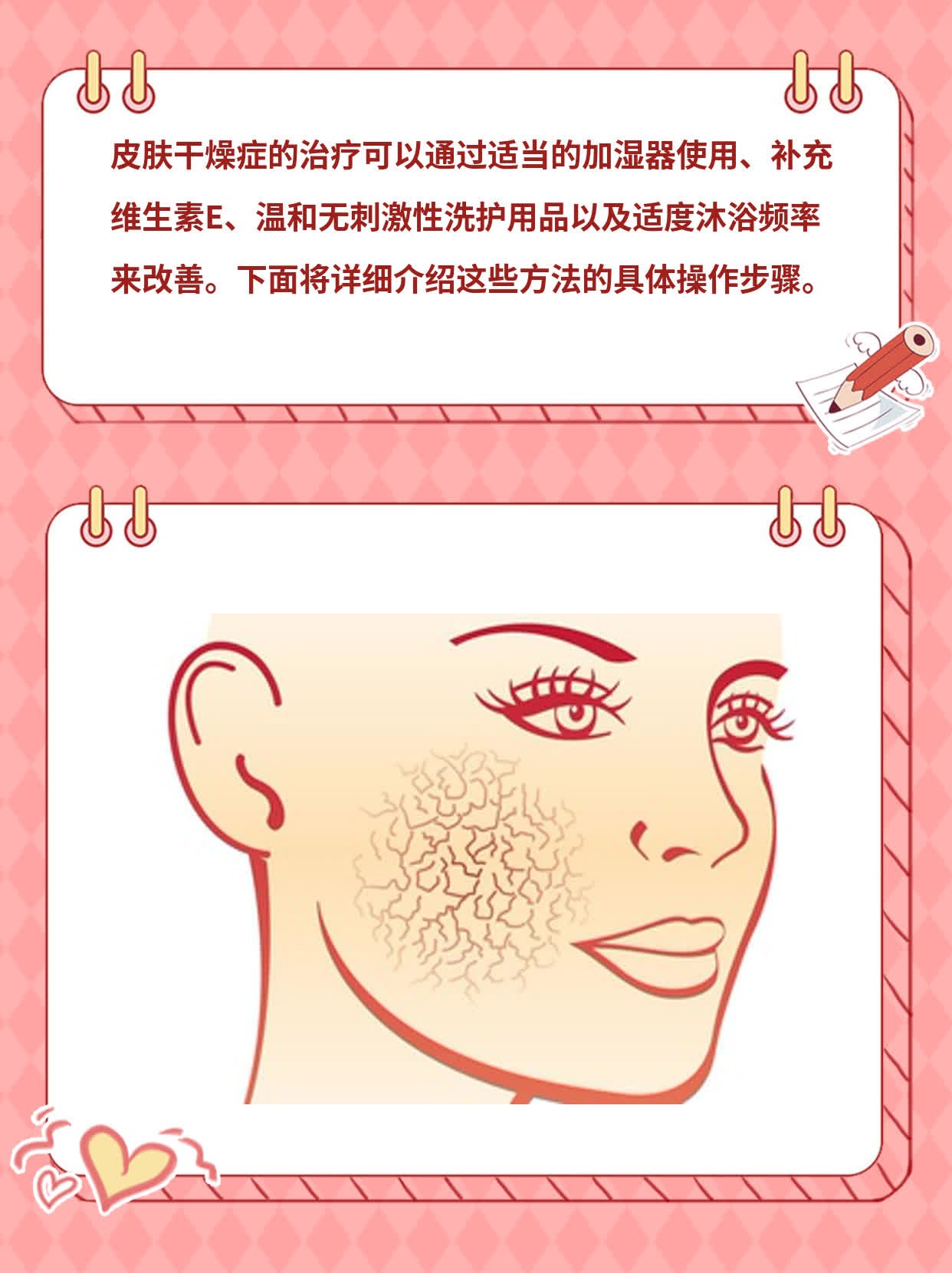 「干货」皮肤干燥症的治疗方法一览表