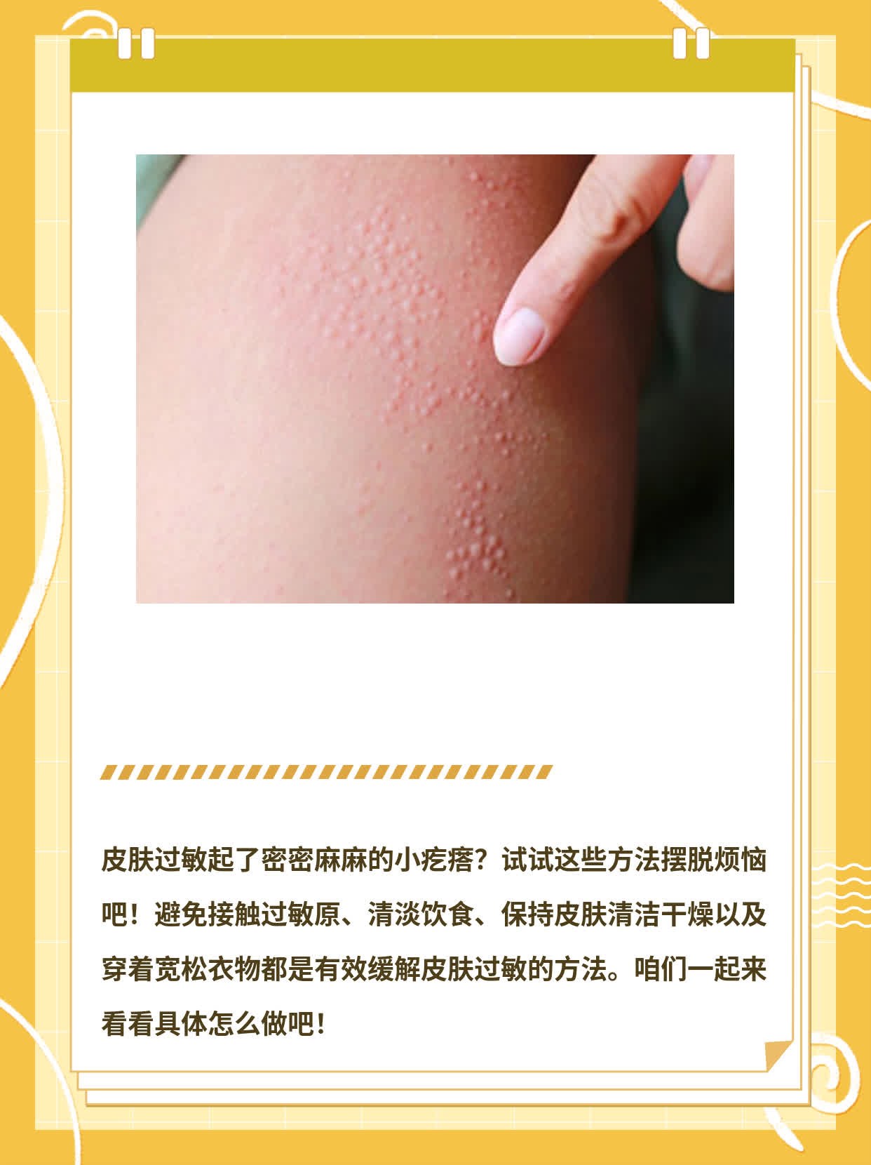 小疙瘩不走？试试这些方法摆脱皮肤过敏！