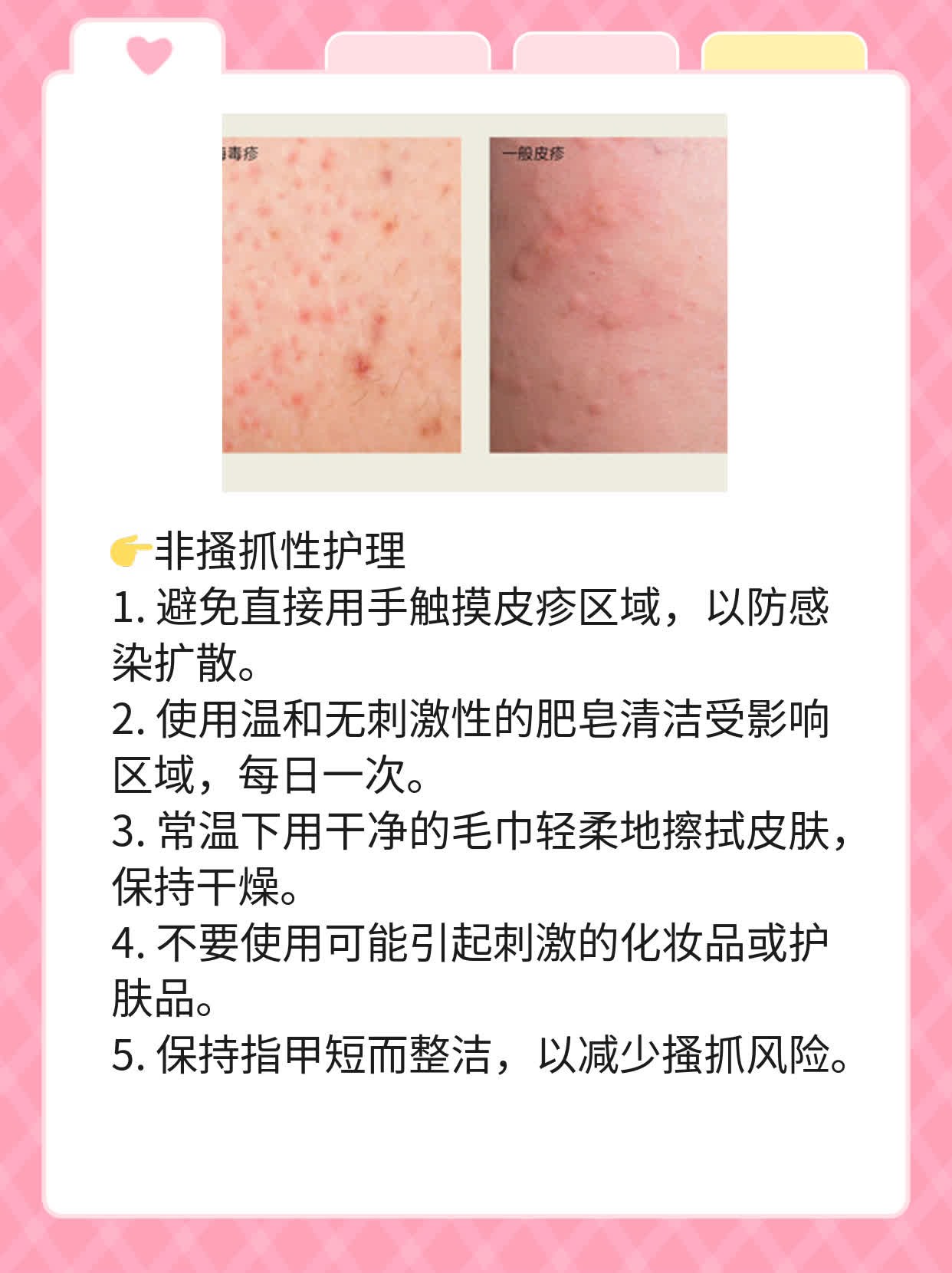 揭秘：艾滋皮疹初现！图示预警！