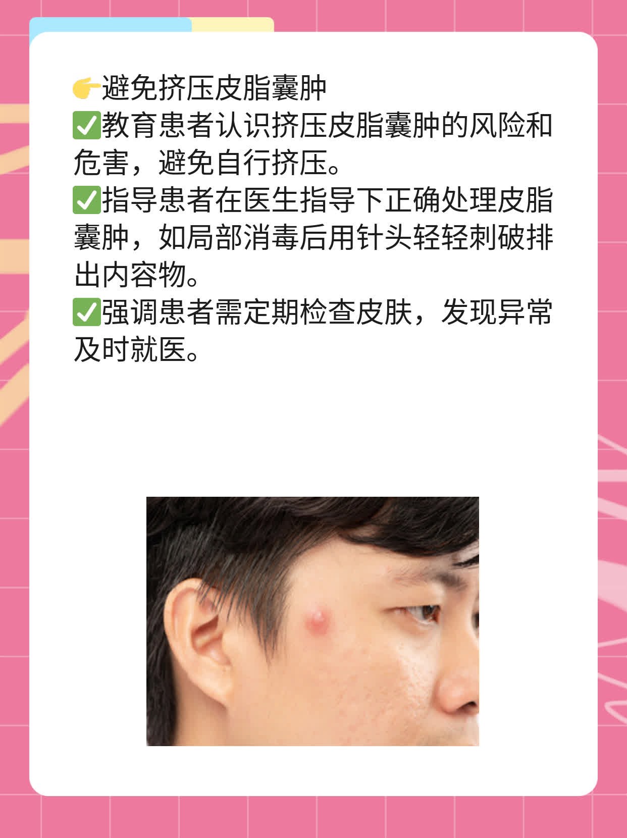 探秘：挤出的白物是啥？——挤痘小技巧大揭秘！