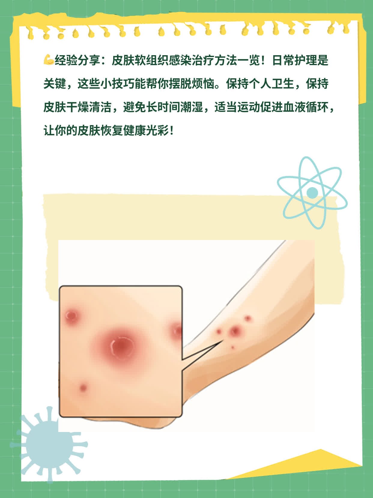 「经验分享」皮肤软组织感染治疗方法一览