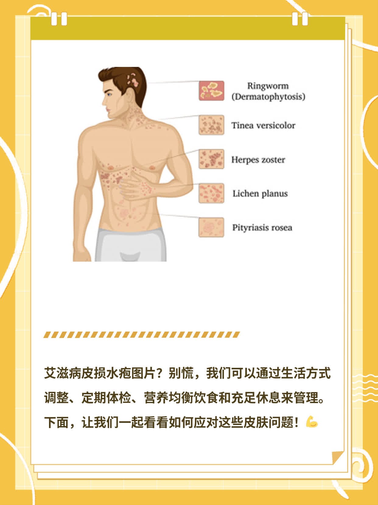 「有图有真相」艾滋病皮损水疱大集合！
