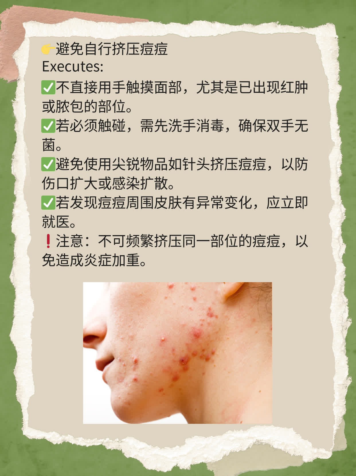 挤痘导致颅内感染的时间？经验分享！