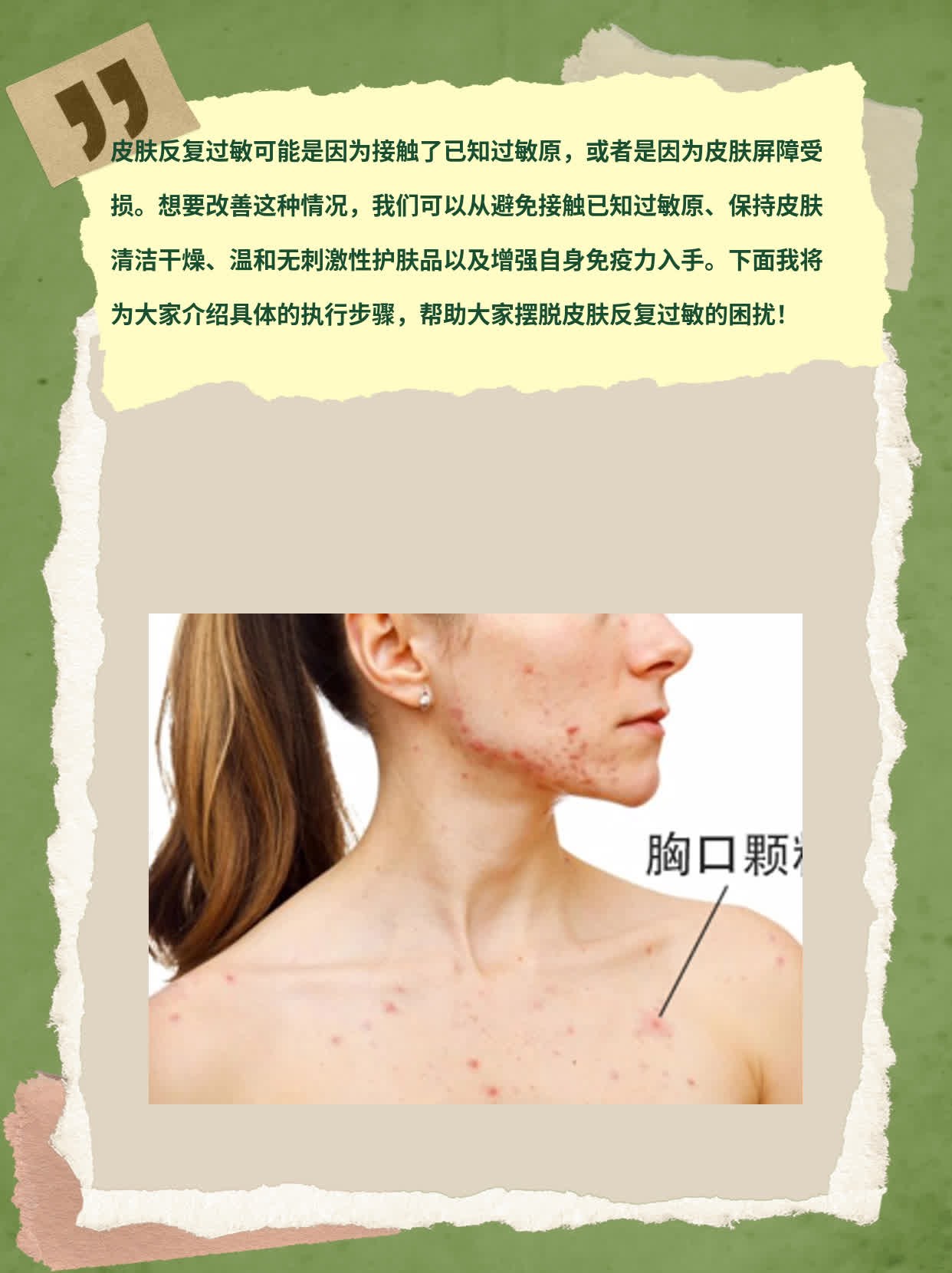揭秘皮肤反复过敏的真相！