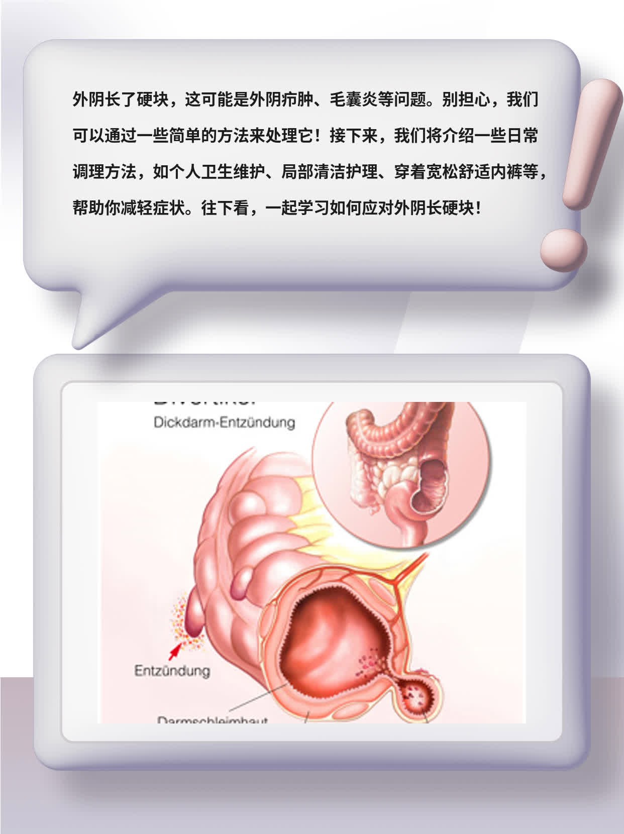 外阴长硬块:小疙瘩变硬包?这些原因要考虑!