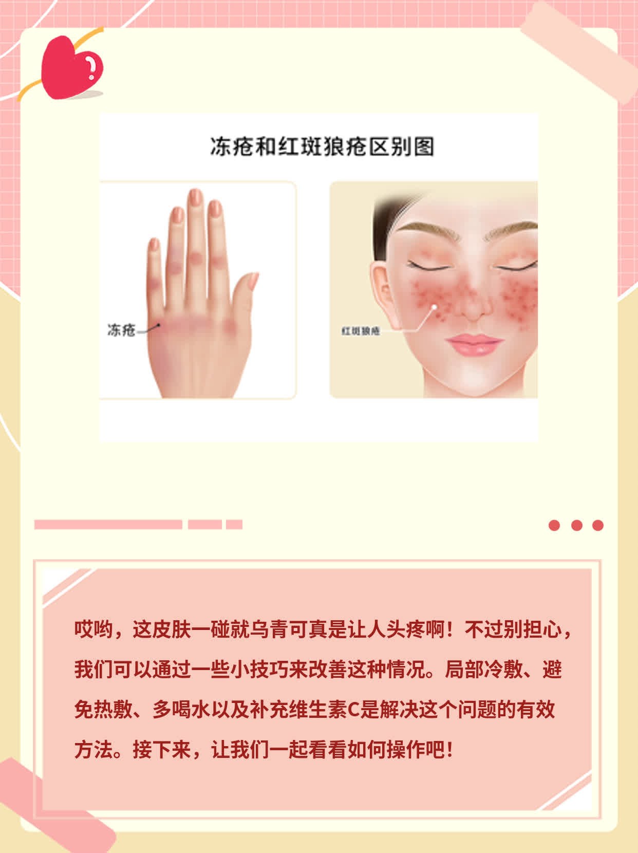 揭秘：皮肤碰撞后变青紫之谜！