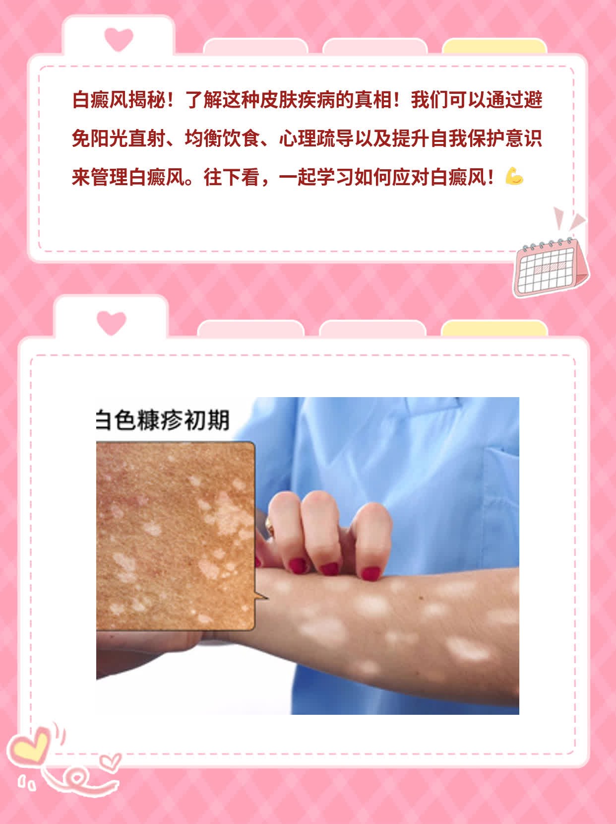 「揭秘」白癜风：了解这种皮肤疾病的真相！