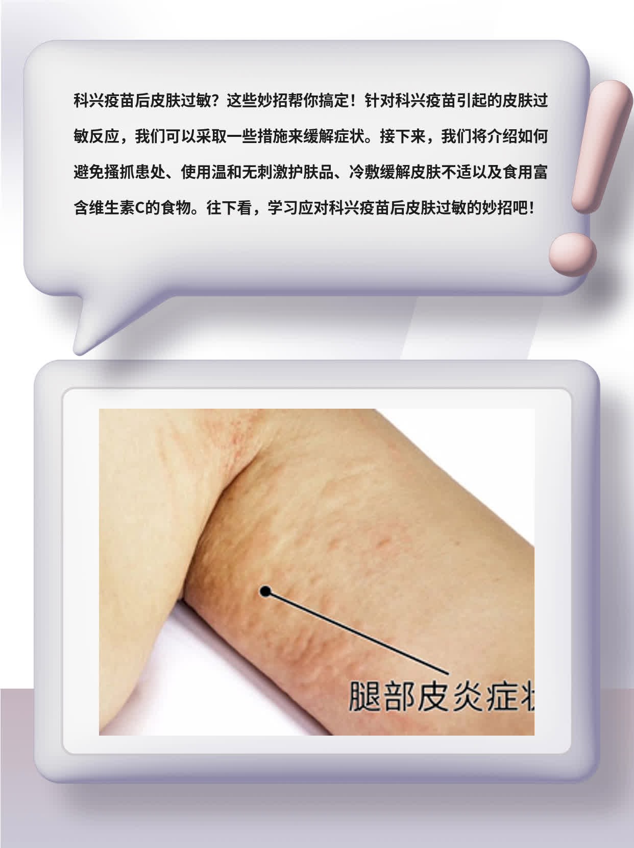 「科兴疫苗后皮肤过敏」应对妙招：如何处理？
