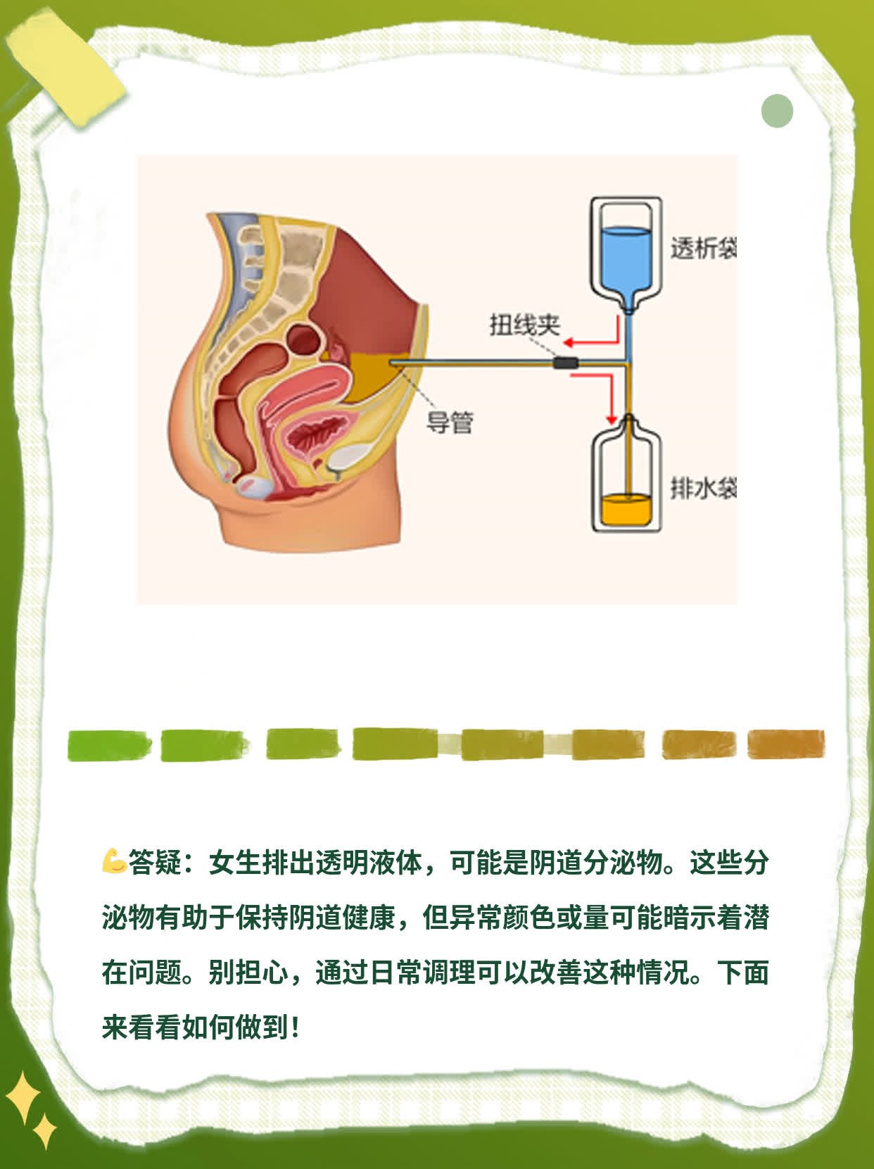 「答疑」女生排出透明液体，真相大揭秘！