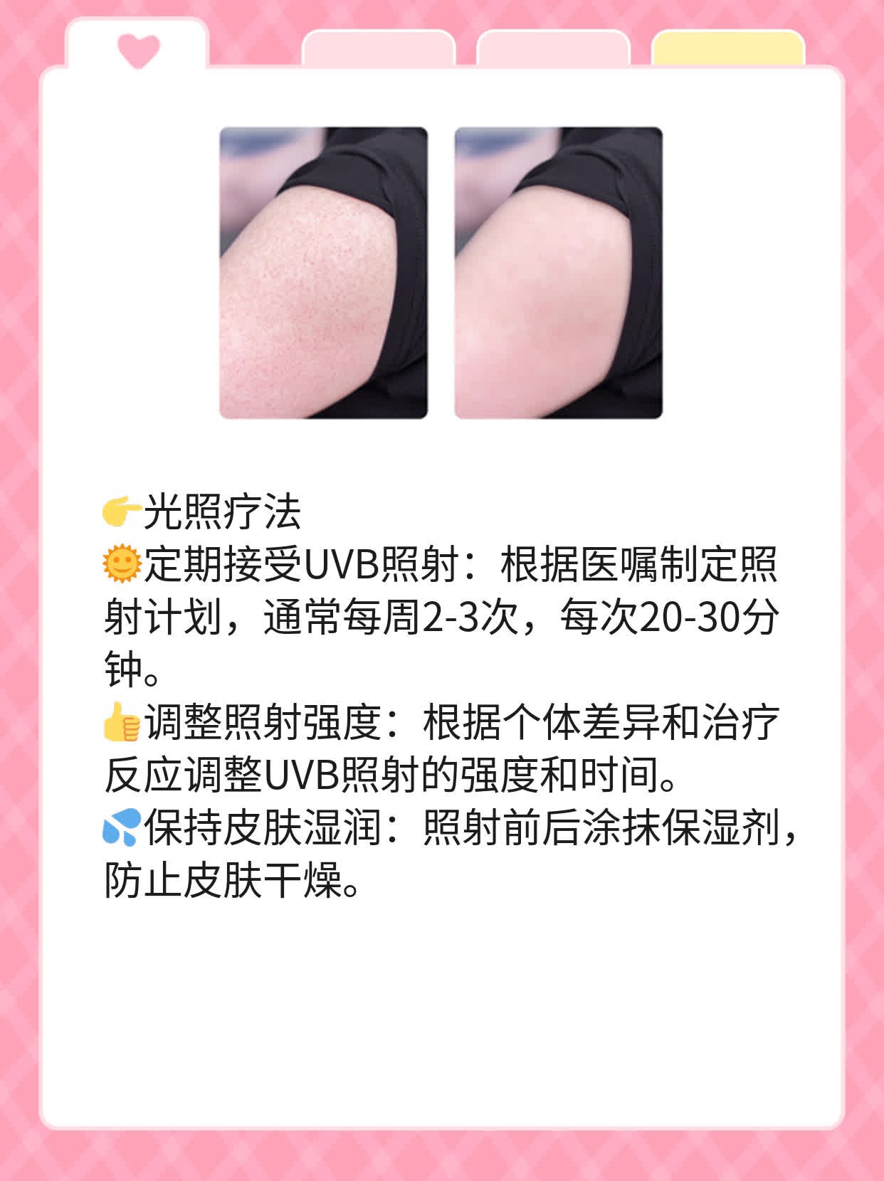 「揭秘」白癜风：病因&疗法全解析！