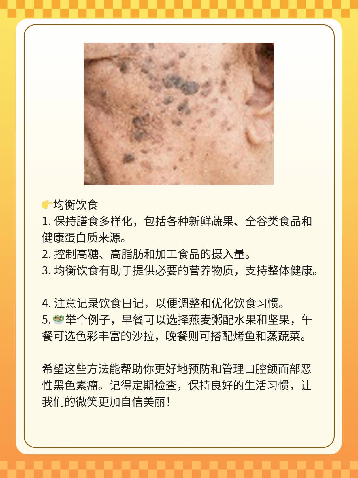 「有图有真相」：口腔颌面部恶性黑色素瘤的黑斑识别指南