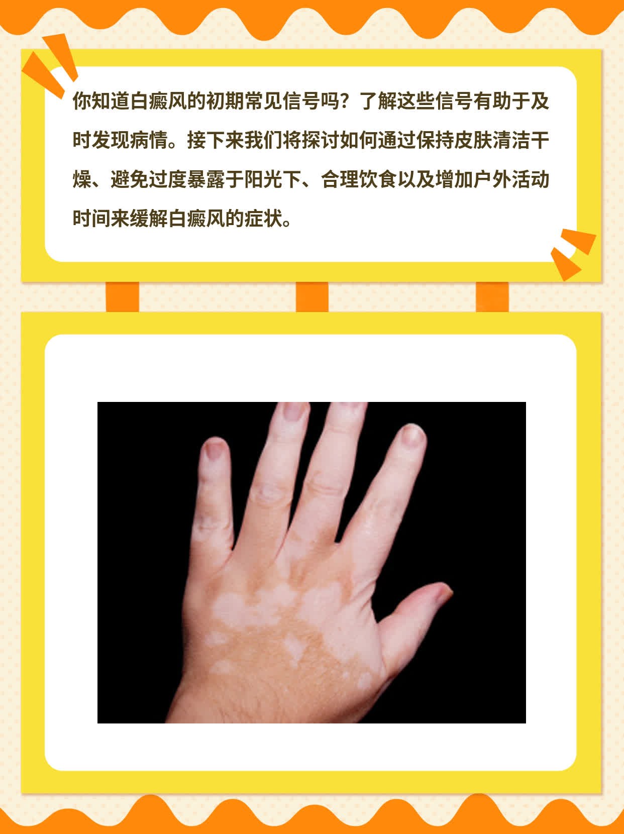 「分享经验」：白癜风初期常见信号你知道吗？