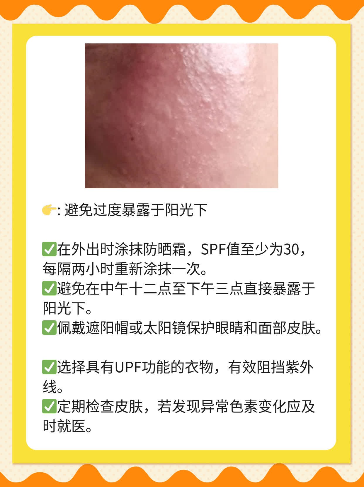 「分享经验」：白癜风初期常见信号你知道吗？