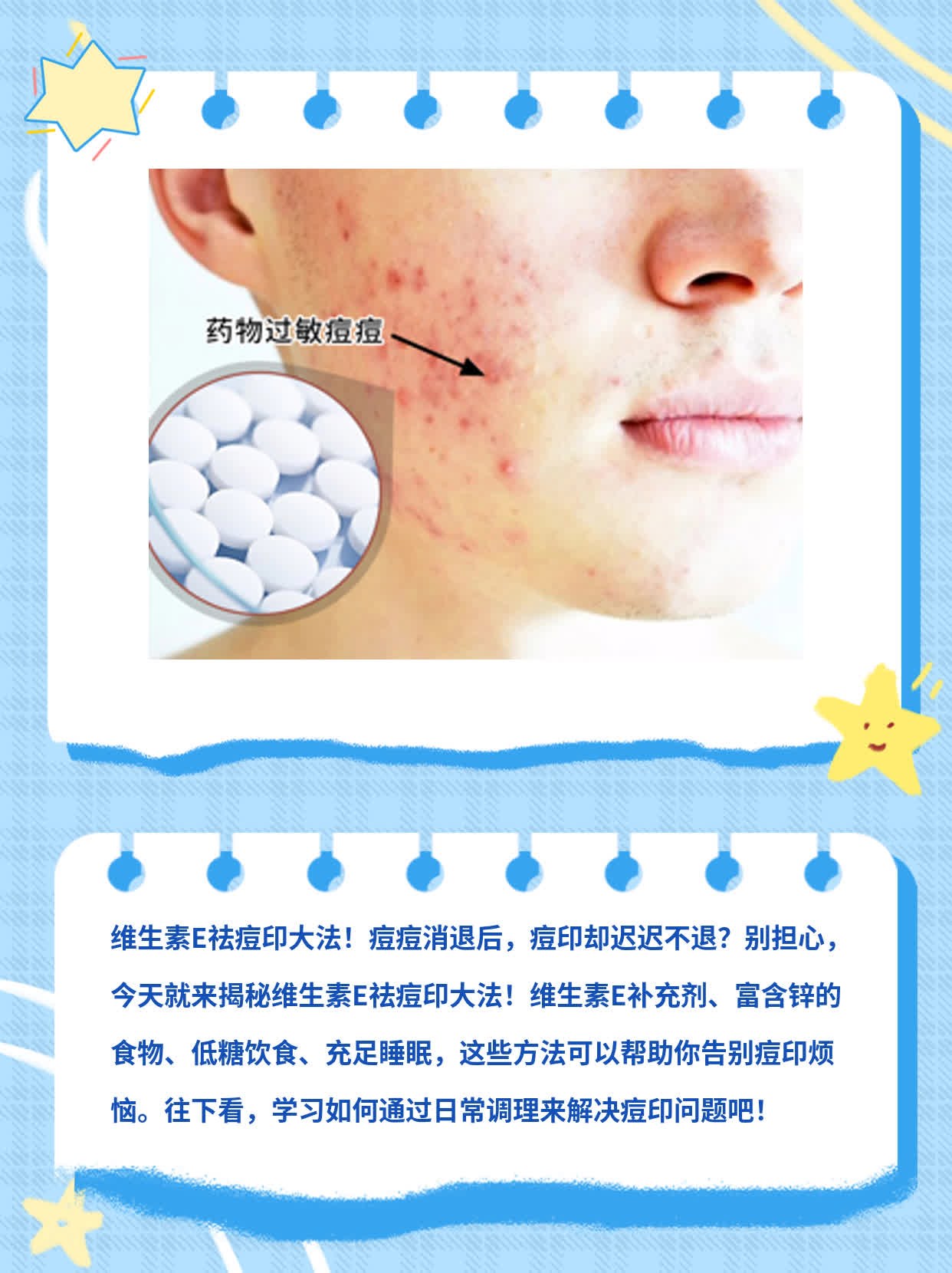 揭秘：维生素E祛痘印大法！