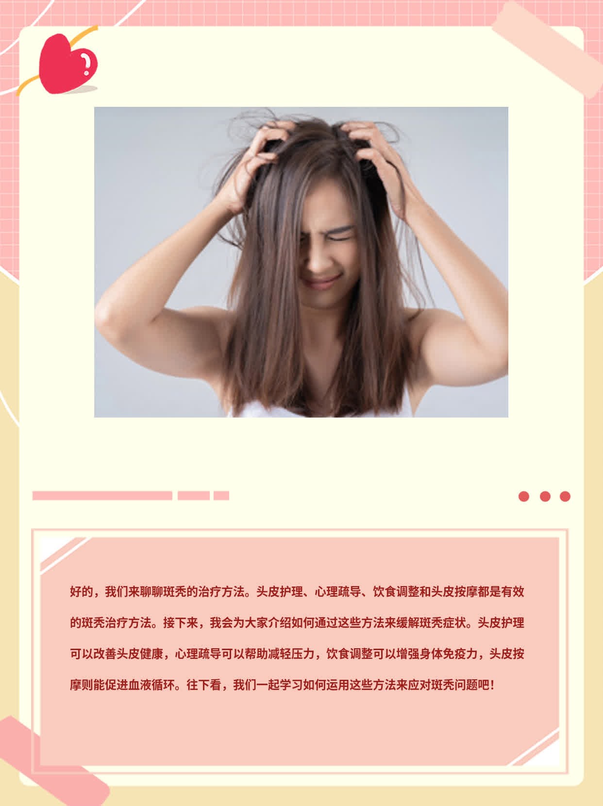 「分享」斑秃治疗法大全！
