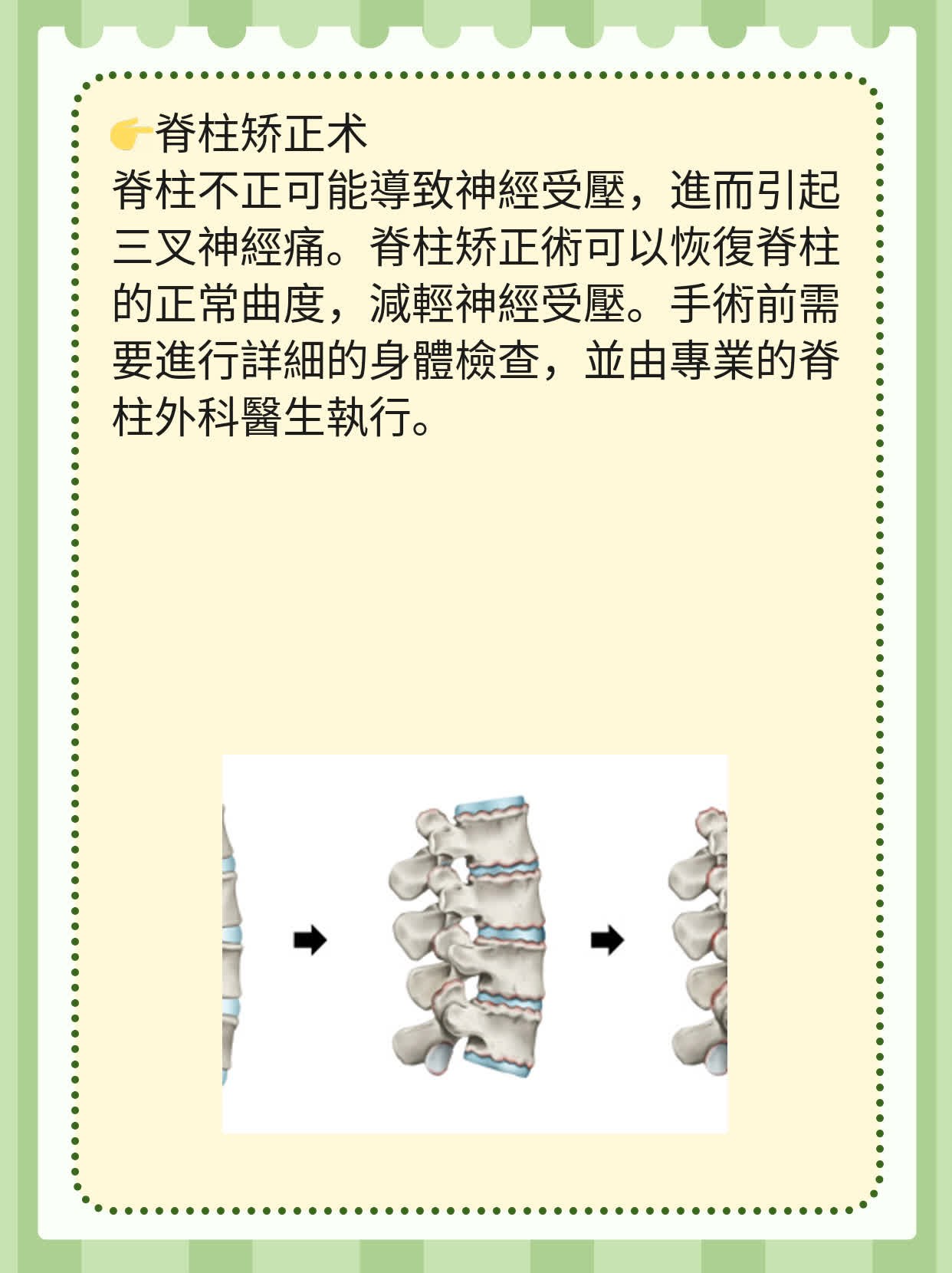揭秘三叉神经痛的症状大全！