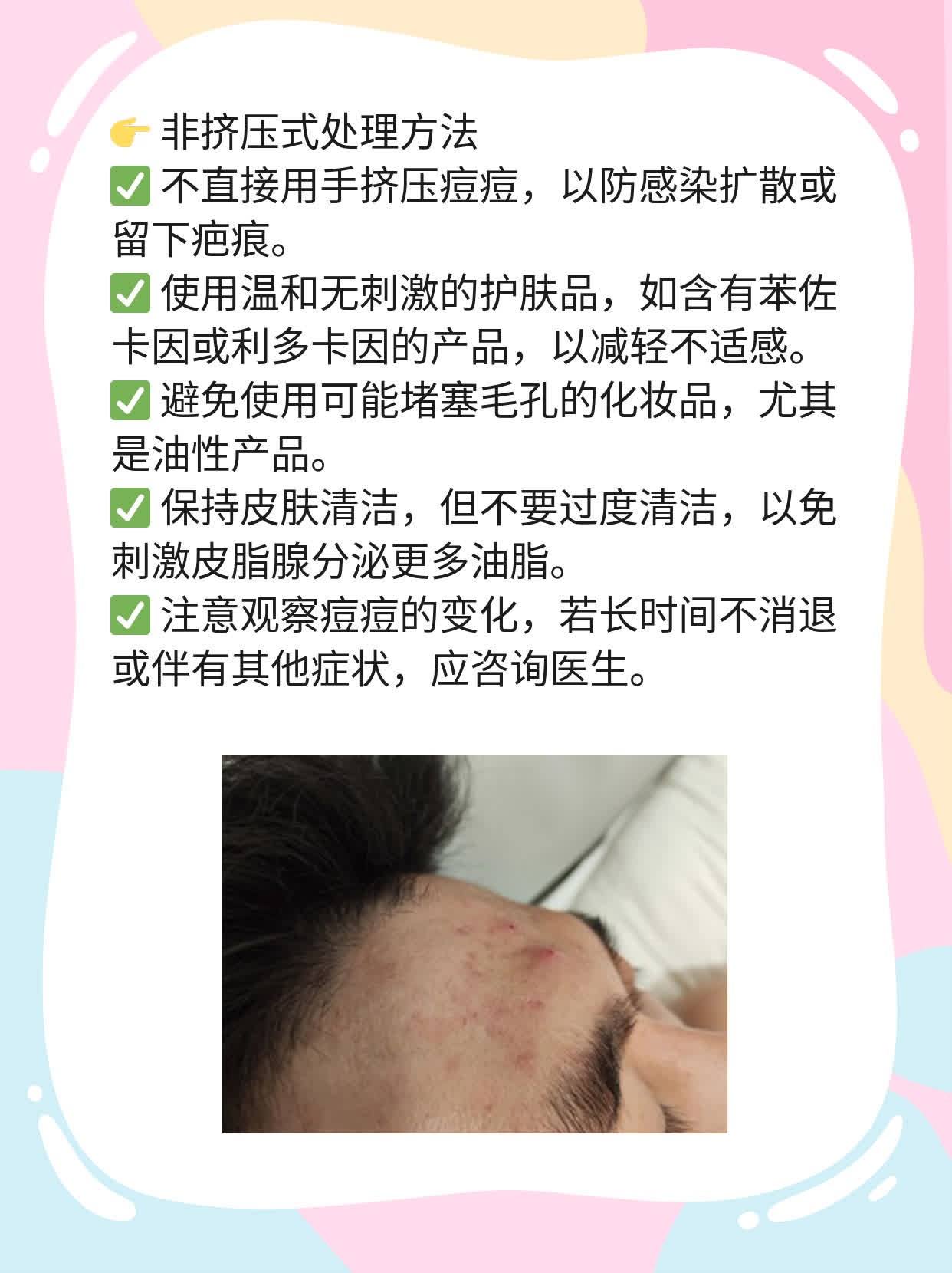「有图有真相」处理挤出白脓的痘痘攻略