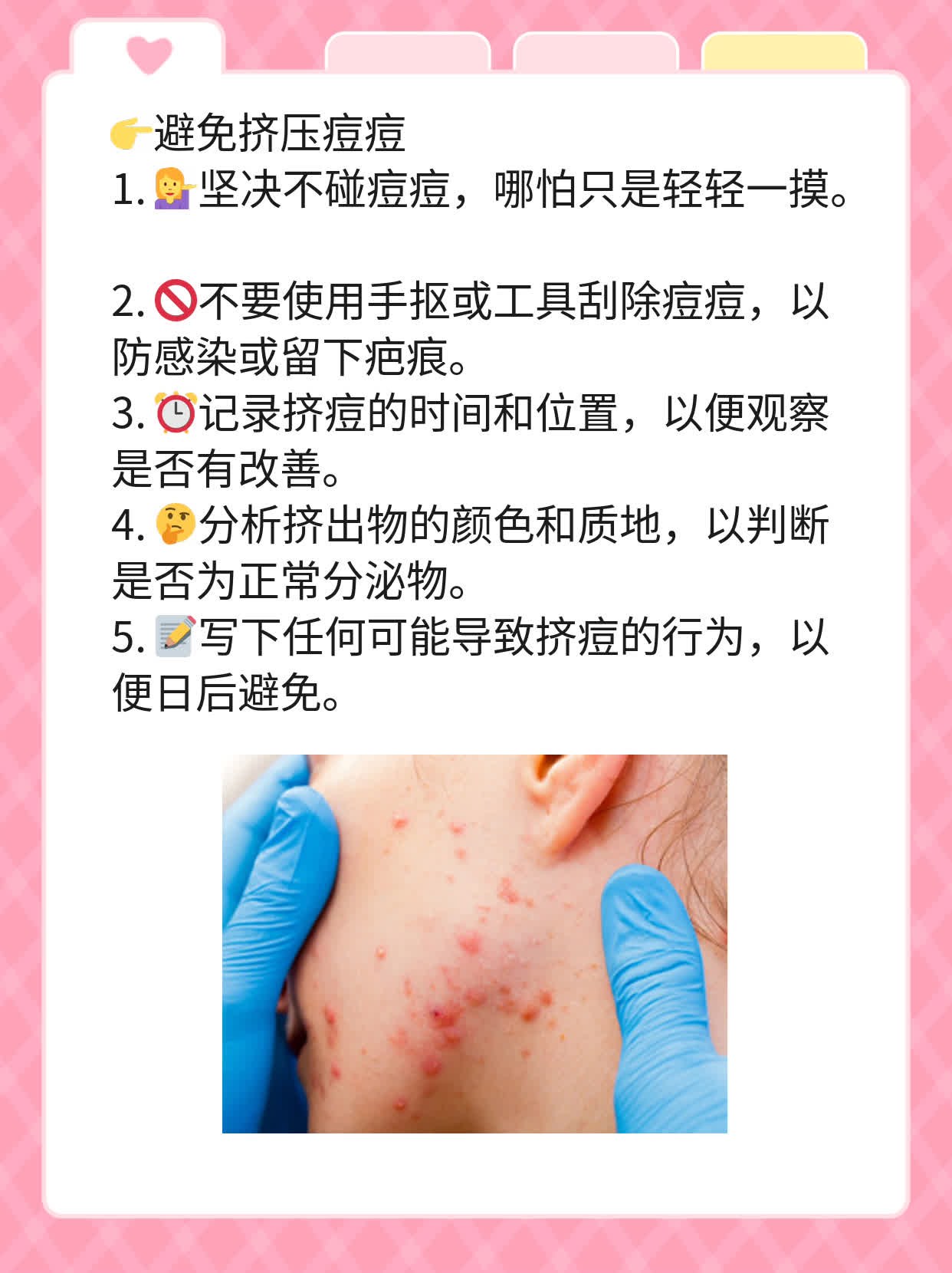 挤出白色硬物是痘栓吗？探寻痘痘内部奥秘！