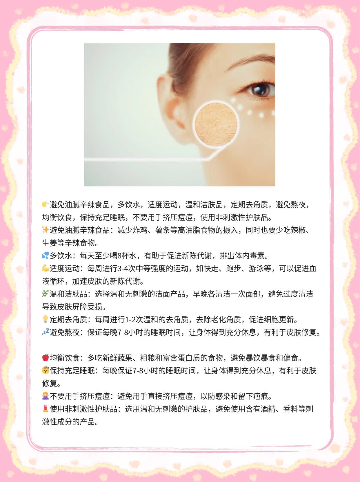 揭秘：脸上的痘痘和粉刺元凶！