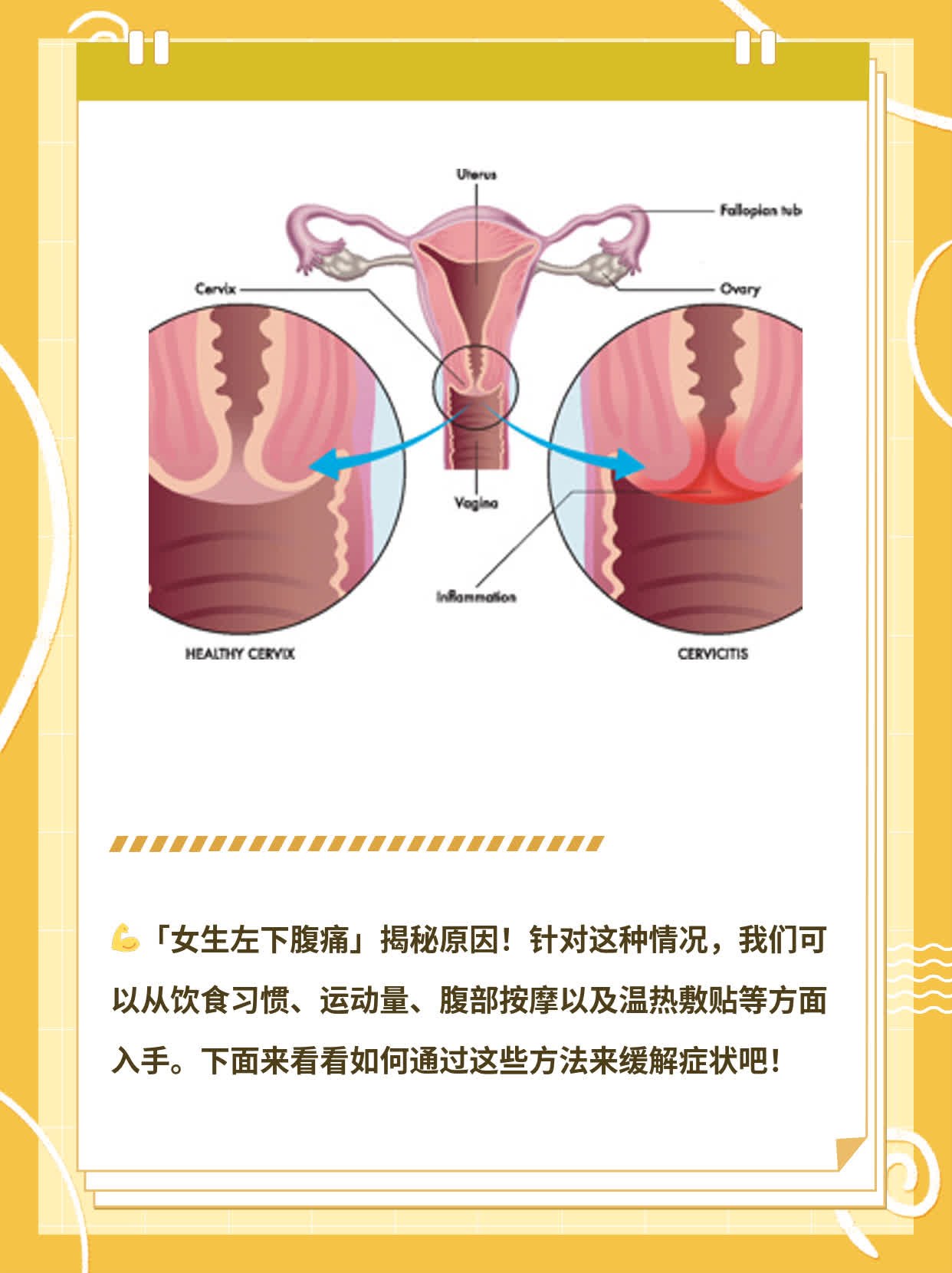 「女生左下腹痛」揭秘原因！