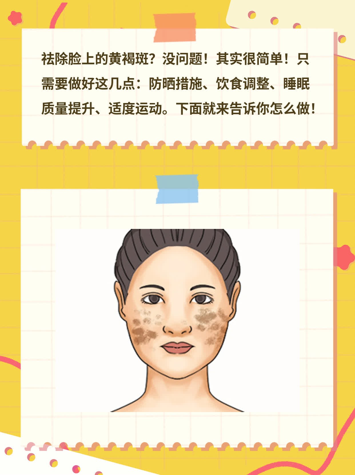 「祛除脸上的黄褐斑」妙招大公开！