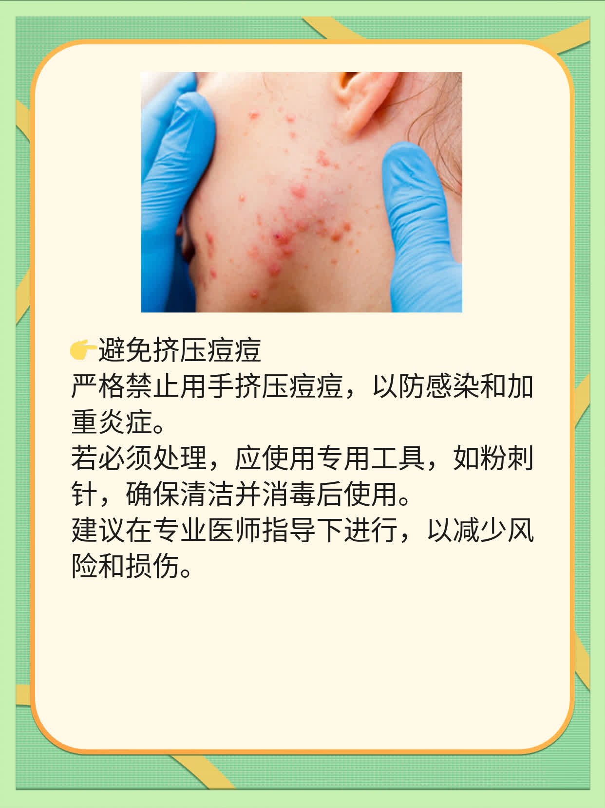 祛痘印、坑？这些妙招帮你搞定！