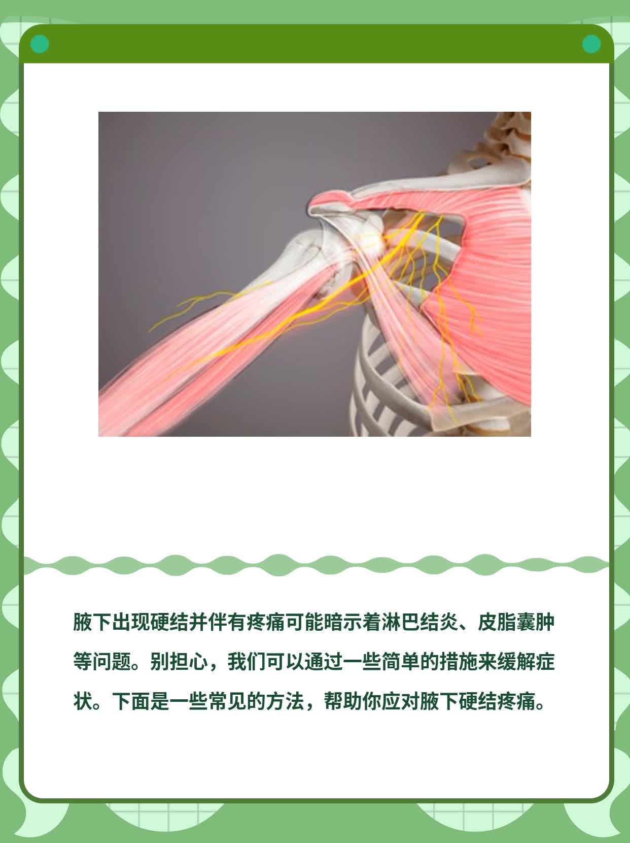 腋下硬结疼痛？这可能是它的原因！
