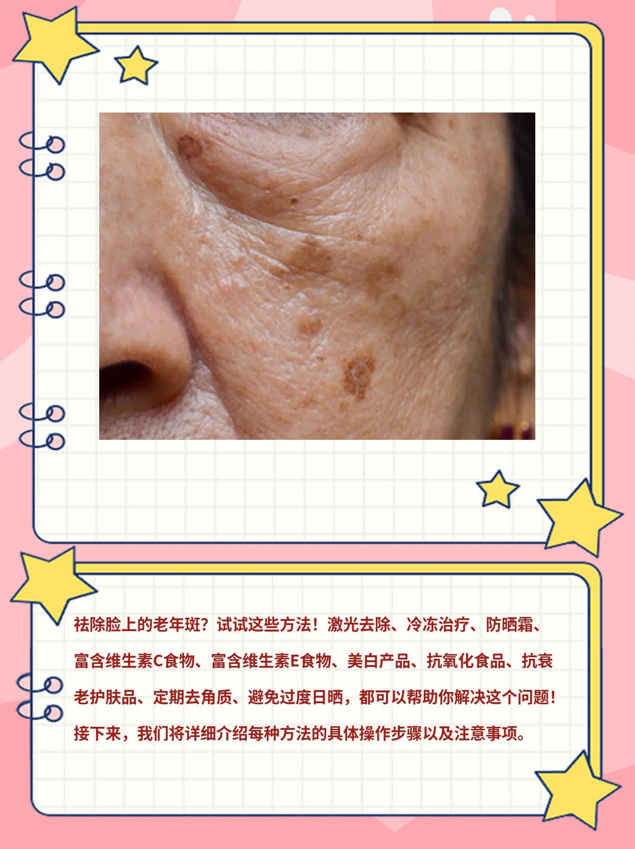 祛除脸上的老年斑？试试这些方法！